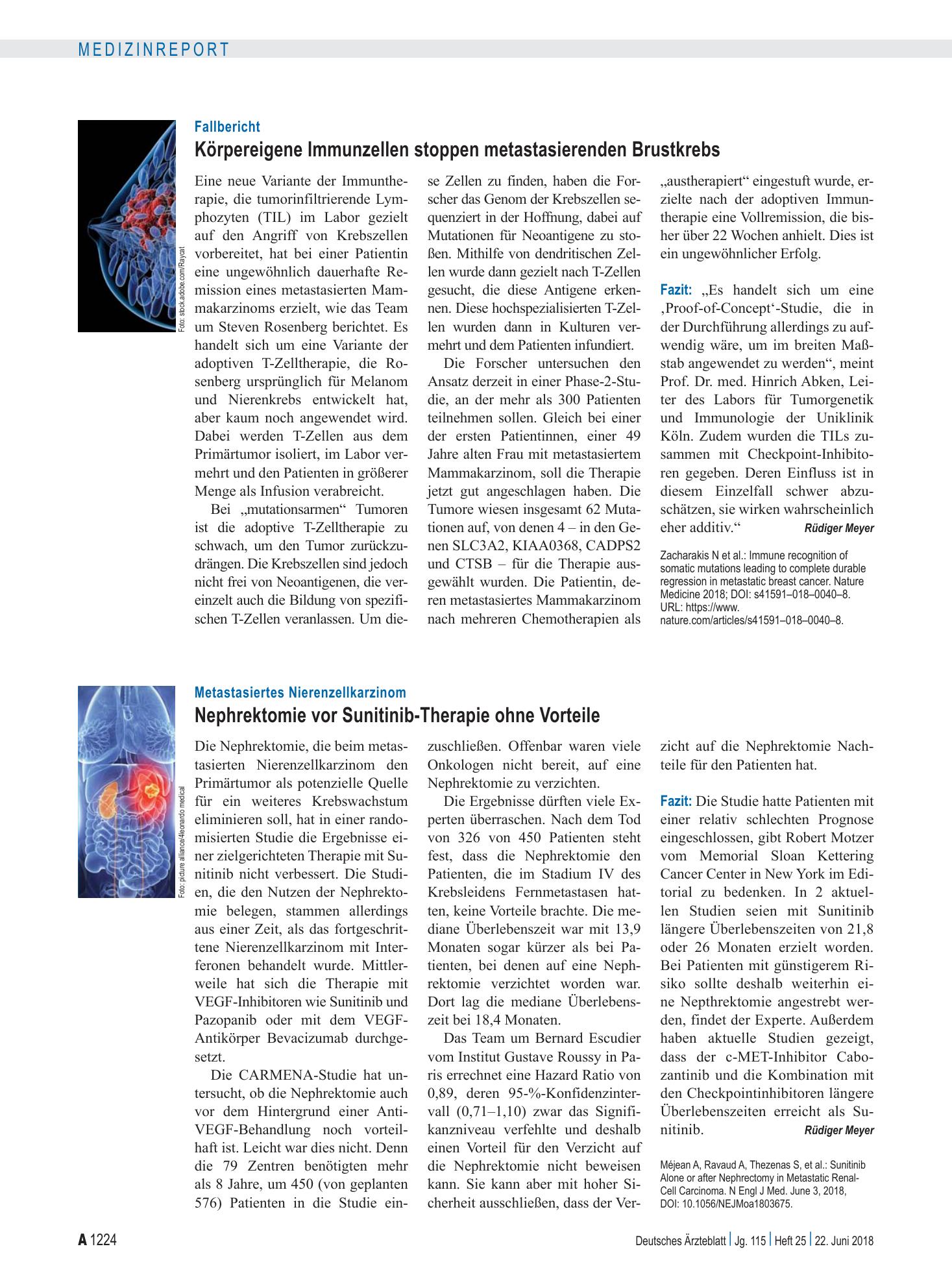 Vorschauseite 1: Fallbericht: Körpereigene Immunzellen stoppen metastasierenden Brustkrebs – Deutsches Ärzteblatt