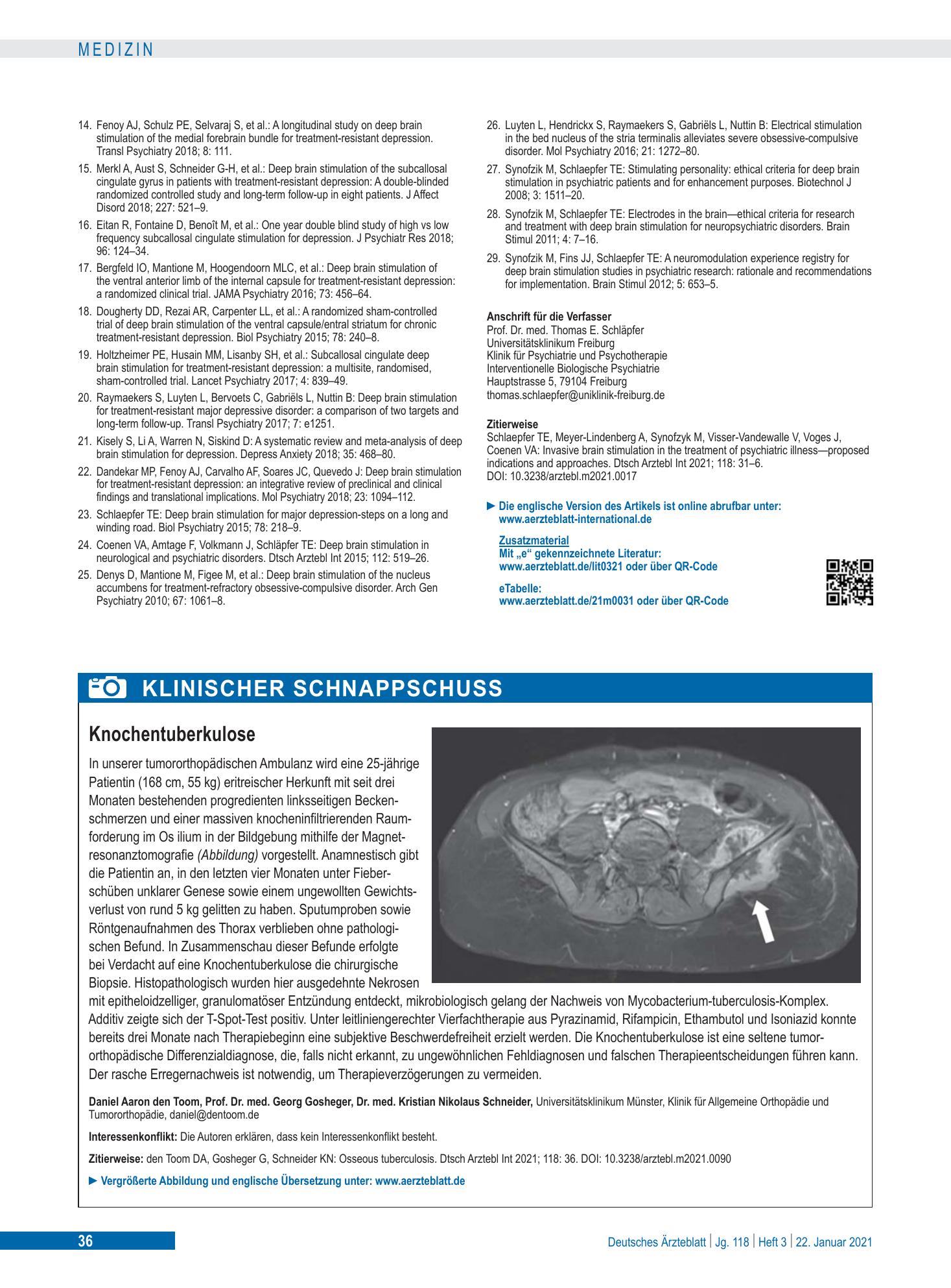 Vorschauseite 1: Knochentuberkulose – Deutsches Ärzteblatt