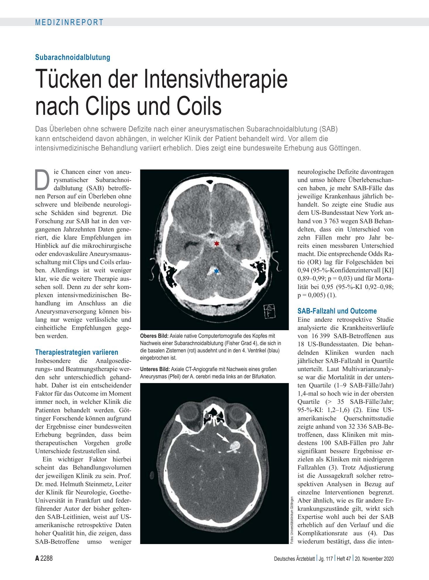 Vorschauseite 1: Subarachnoidalblutung: Tücken der Intensivtherapie nach Clips und Coils – Deutsches Ärzteblatt
