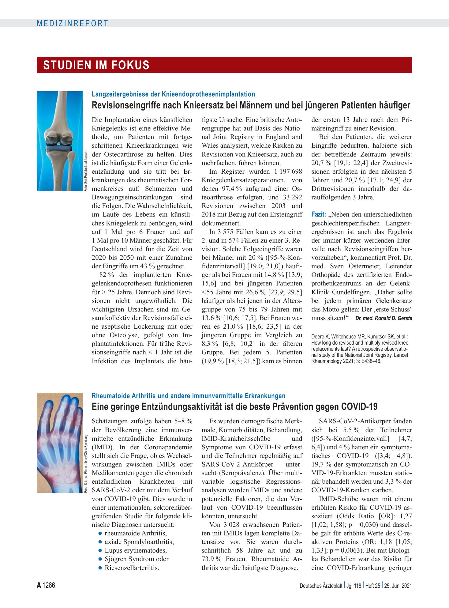Vorschauseite 1: Rheumatoide Arthritis und andere immunvermittelte Erkrankungen: Eine geringe Entzündungsaktivität ist die beste Prävention gegen COVID-19 – Deutsches Ärzteblatt
