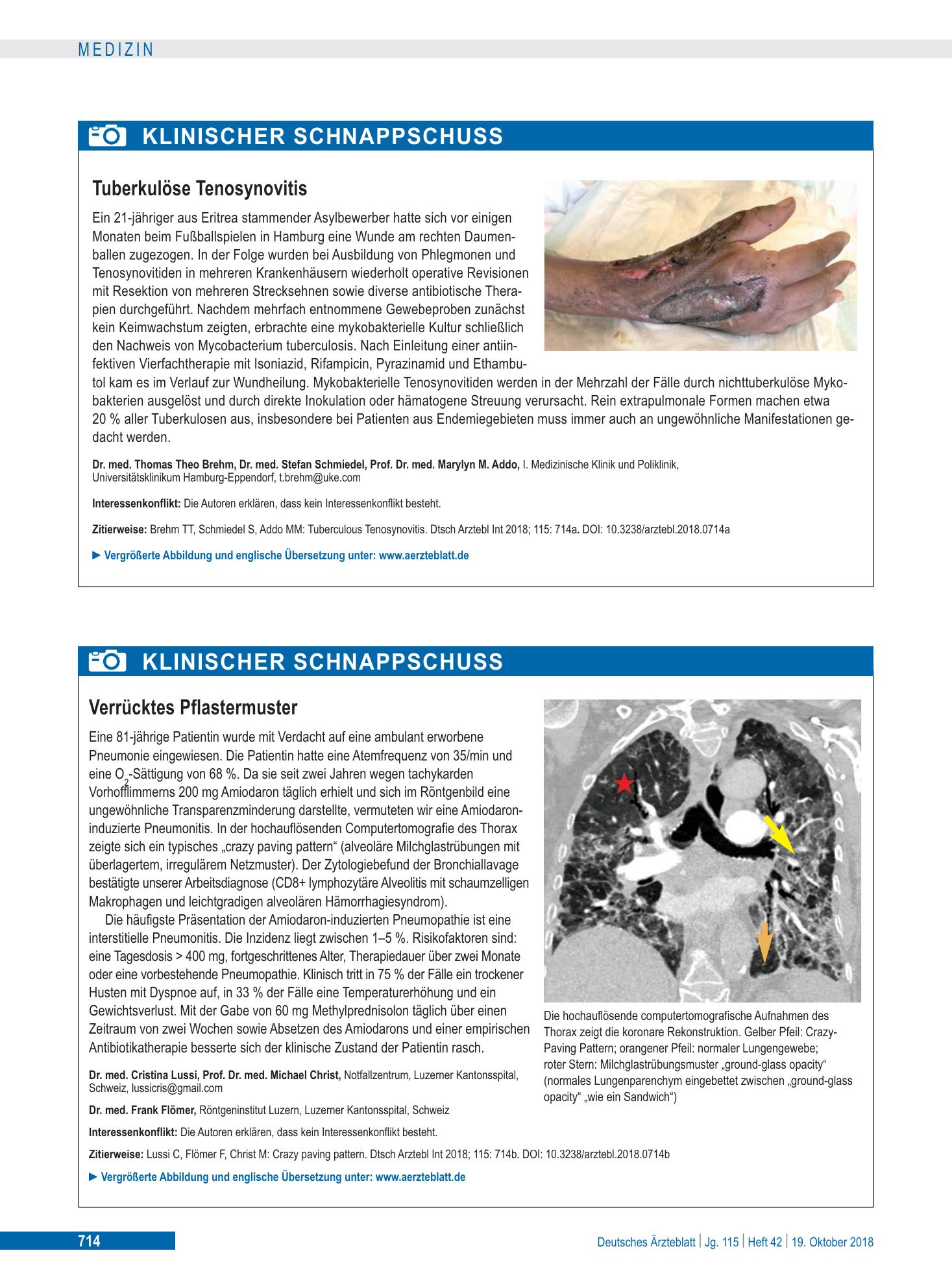 Vorschauseite 1: Tuberkulöse Tenosynovitis – Deutsches Ärzteblatt