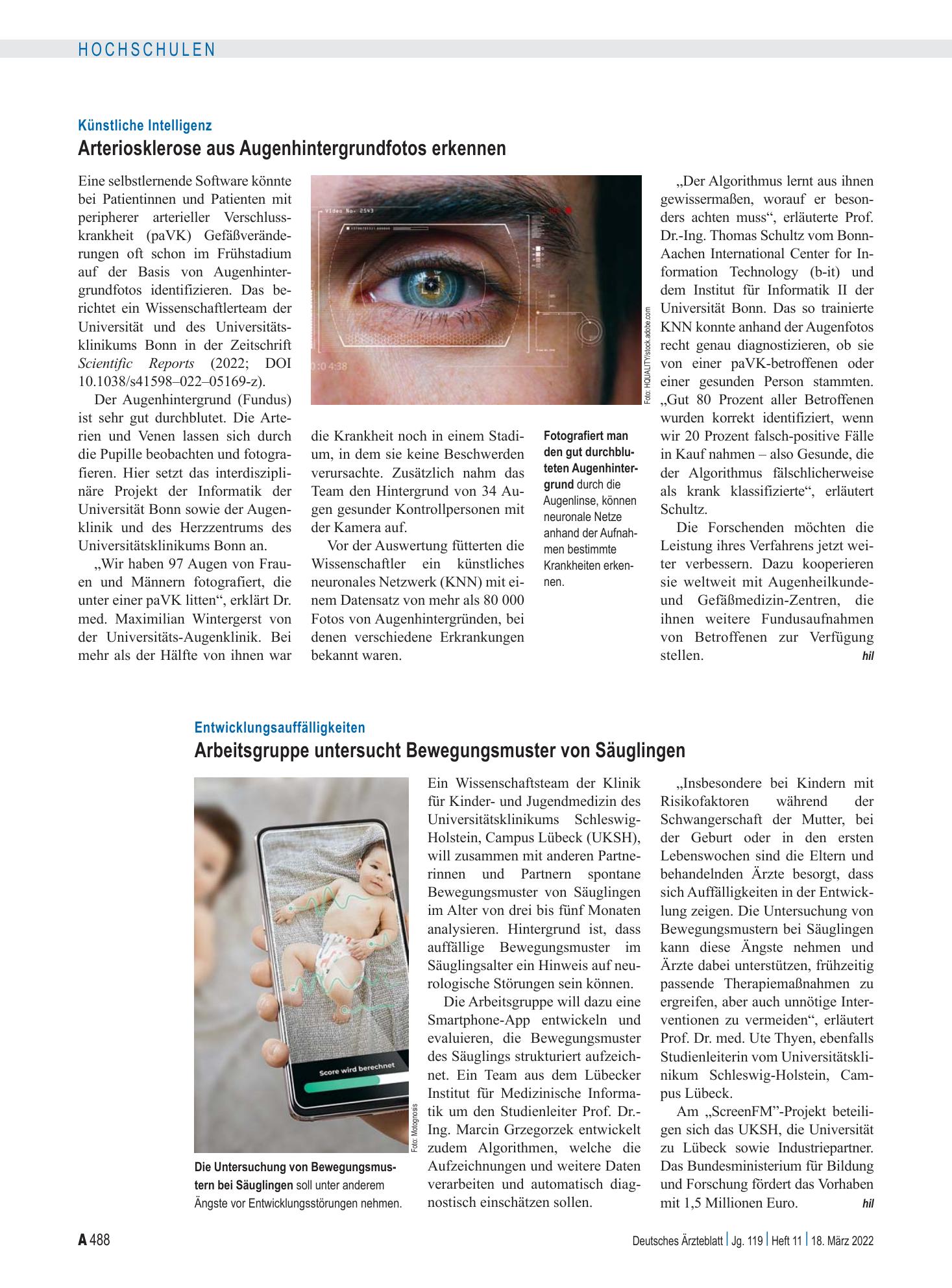 Vorschauseite 1: Entwicklungsauffälligkeiten: Arbeitsgruppe untersucht Bewegungsmuster von Säuglingen – Deutsches Ärzteblatt