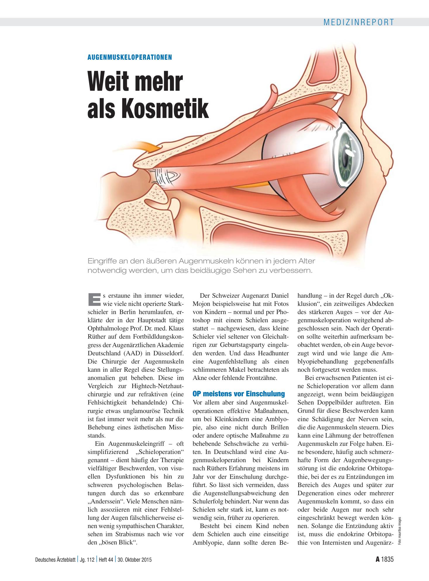 Vorschauseite 1: Augenmuskeloperationen: Weit mehr als Kosmetik – Deutsches Ärzteblatt