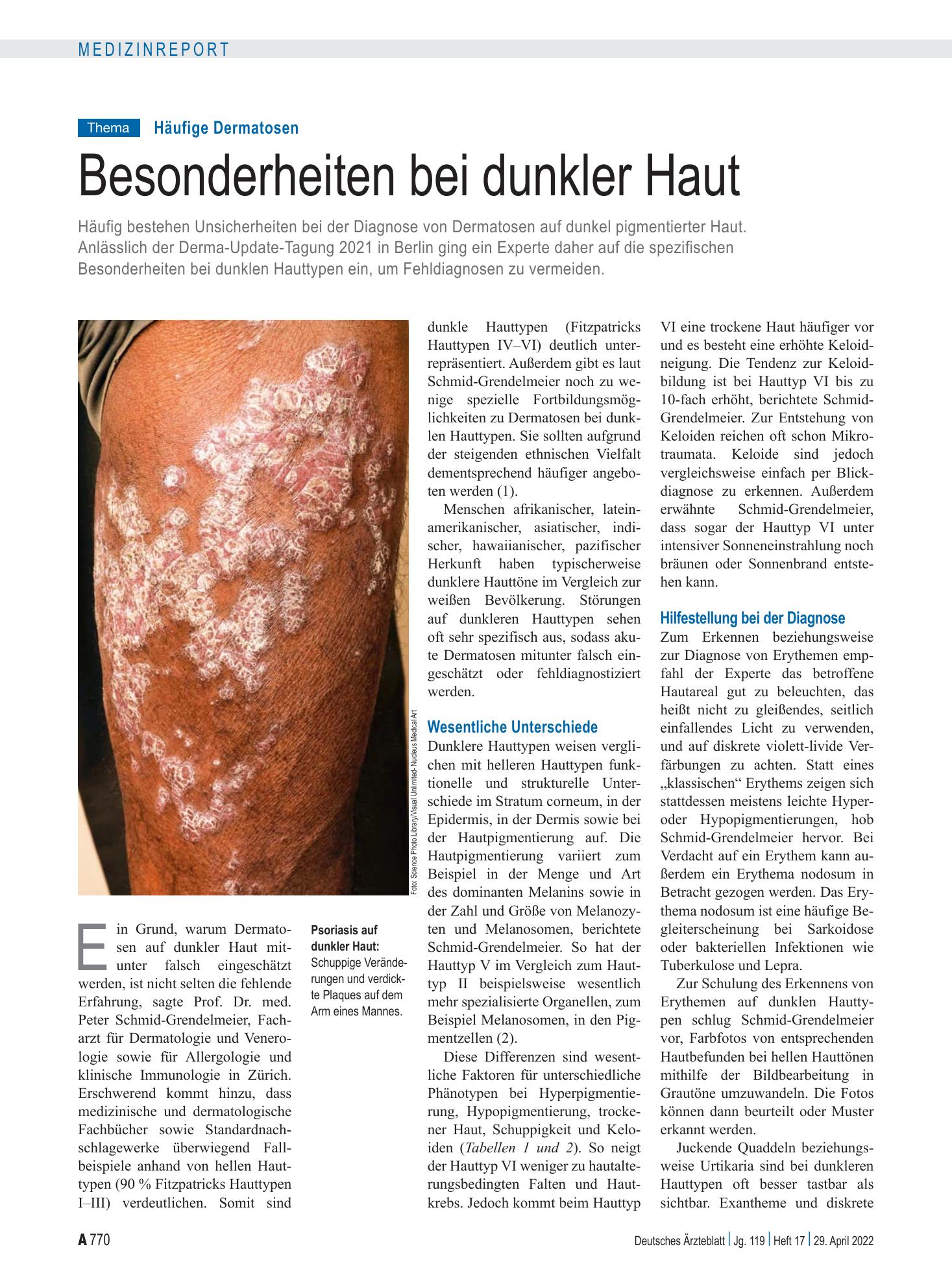 Vorschauseite 1: Häufige Dermatosen: Besonderheiten bei dunkler Haut – Deutsches Ärzteblatt