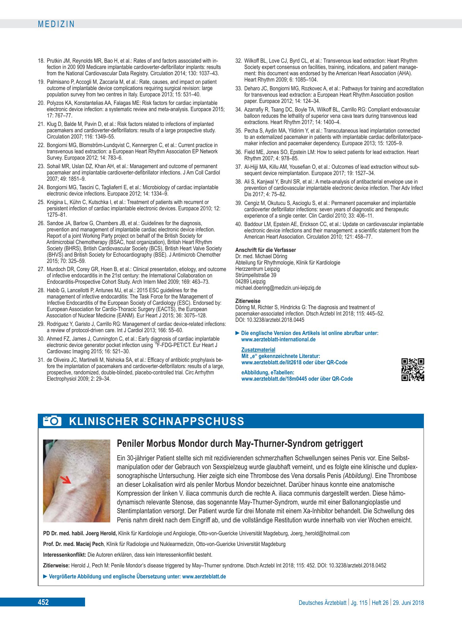 Vorschauseite 1: Peniler Morbus Mondor durch May-Thurner-Syndrom getriggert – Deutsches Ärzteblatt
