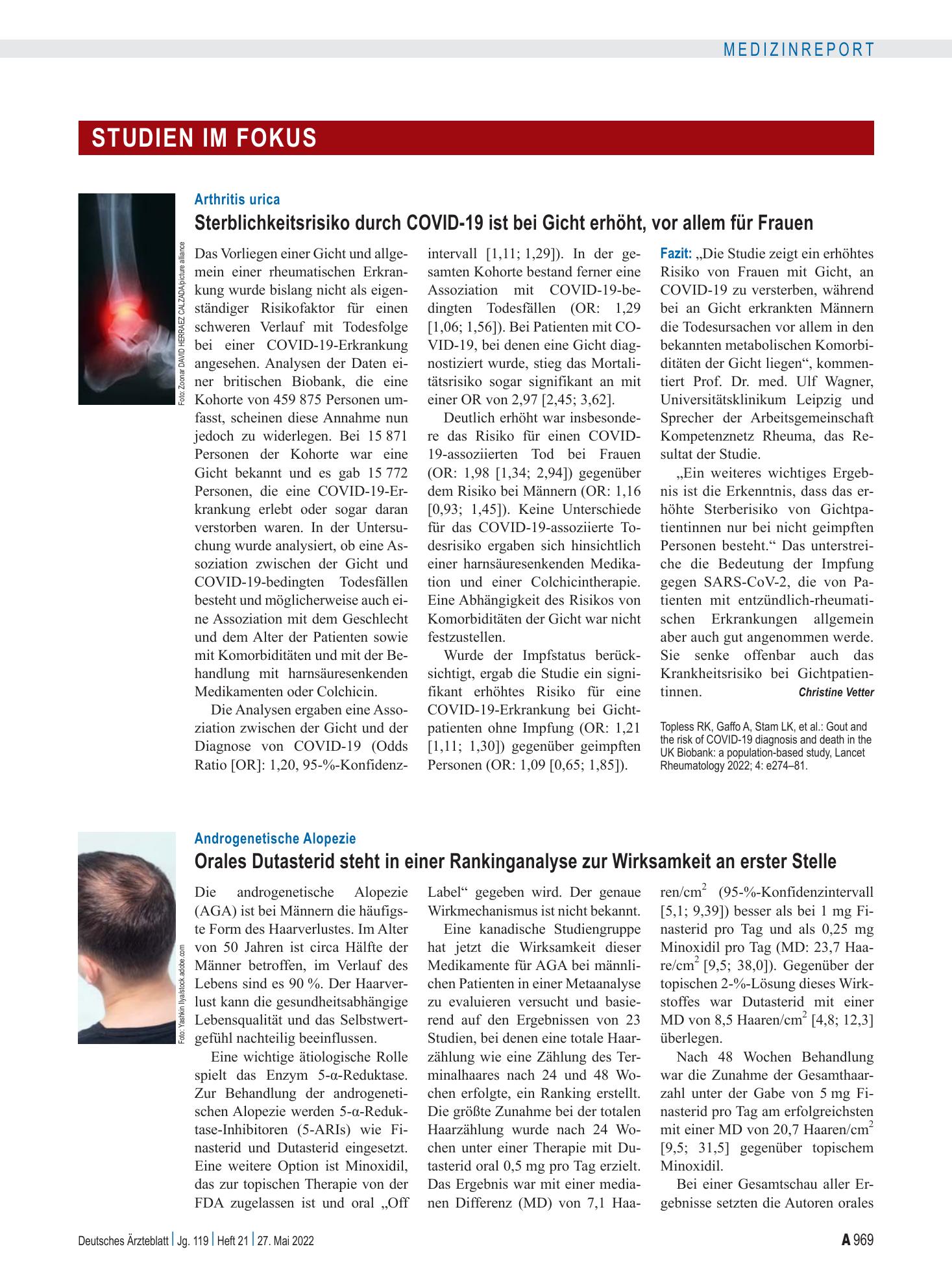 Vorschauseite 1: Androgenetische Alopezie: Orales Dutasterid steht in einer Rankinganalyse zur Wirksamkeit an erster Stelle – Deutsches Ärzteblatt