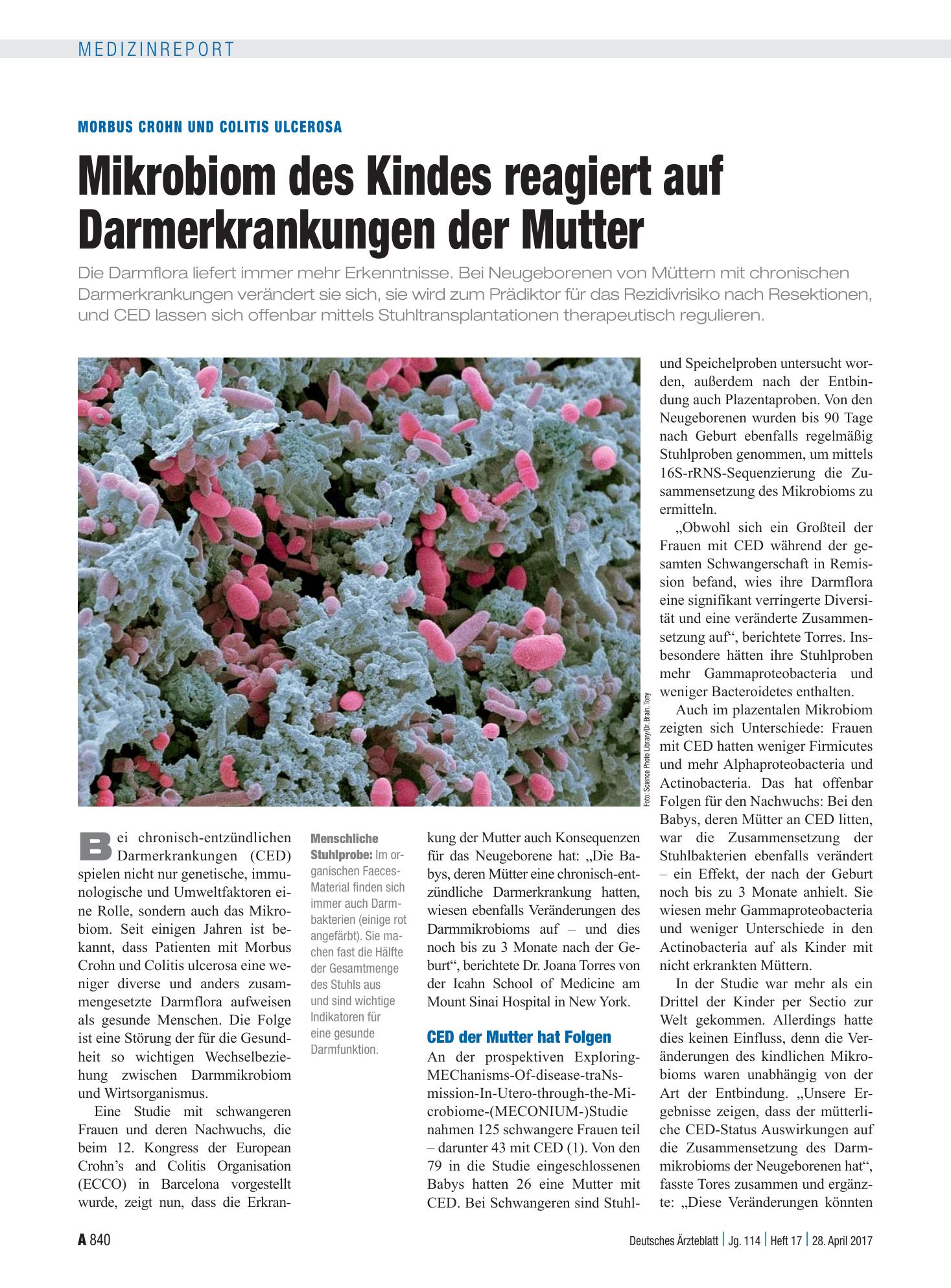 Vorschauseite 1: Morbus Crohn und Colitis Ulcerosa: Mikrobiom des Kindes reagiert auf Darmerkrankungen der Mutter – Deutsches Ärzteblatt