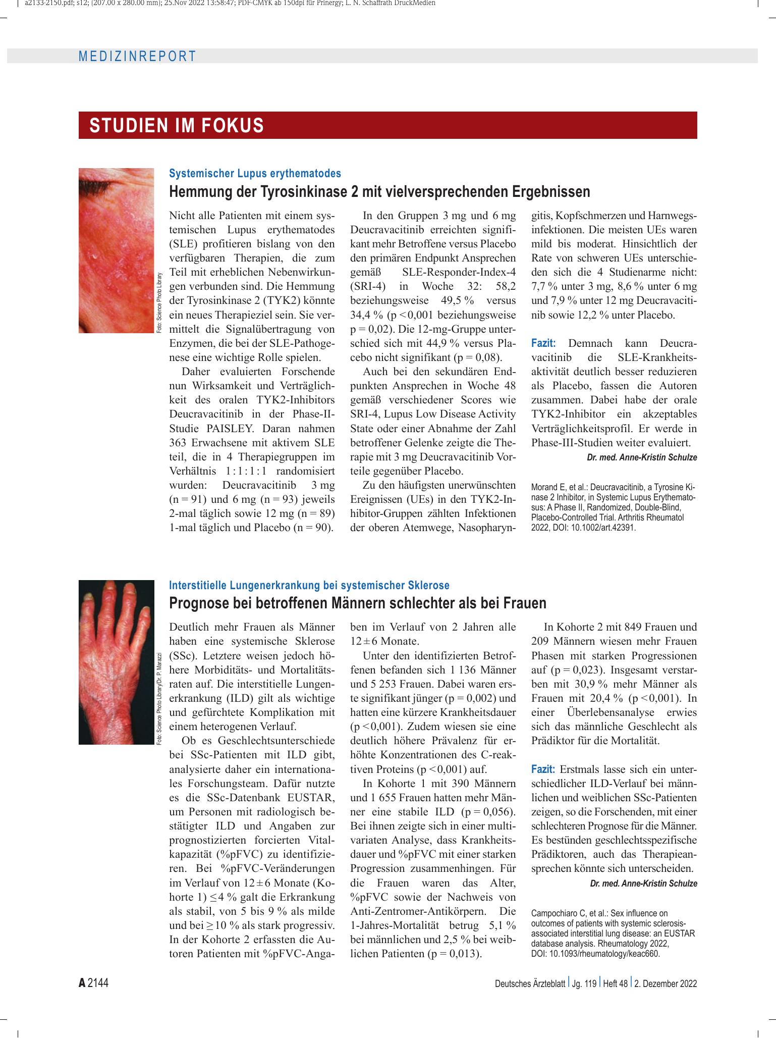 Vorschauseite 1: Systemischer Lupus erythematodes: Hemmung der Tyrosinkinase 2 mit vielversprechenden Ergebnissen – Deutsches Ärzteblatt