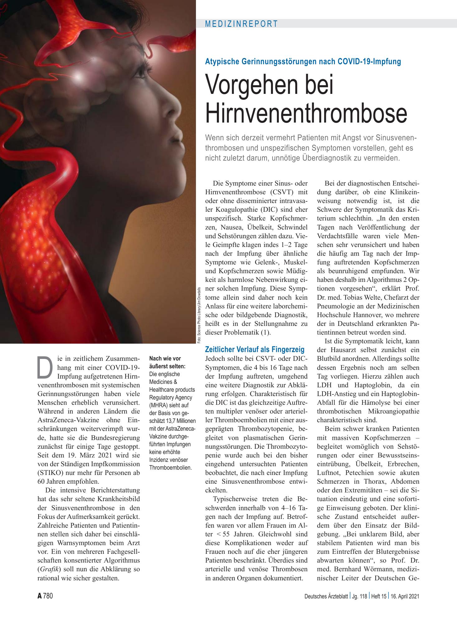 Vorschauseite 1: Atypische Gerinnungsstörungen nach COVID-19-Impfung: Vorgehen bei Hirnvenenthrombose – Deutsches Ärzteblatt