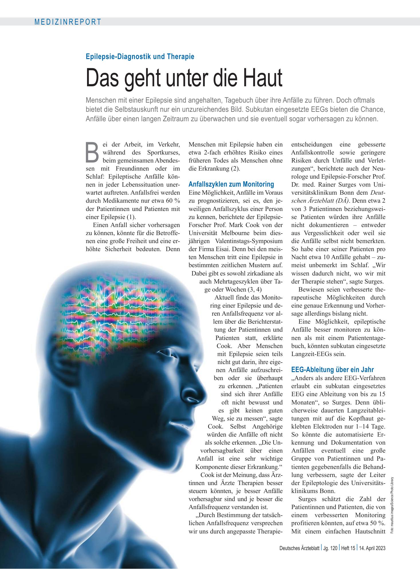 Vorschauseite 1: Epilepsie-Diagnostik und Therapie: Das geht unter die Haut – Deutsches Ärzteblatt