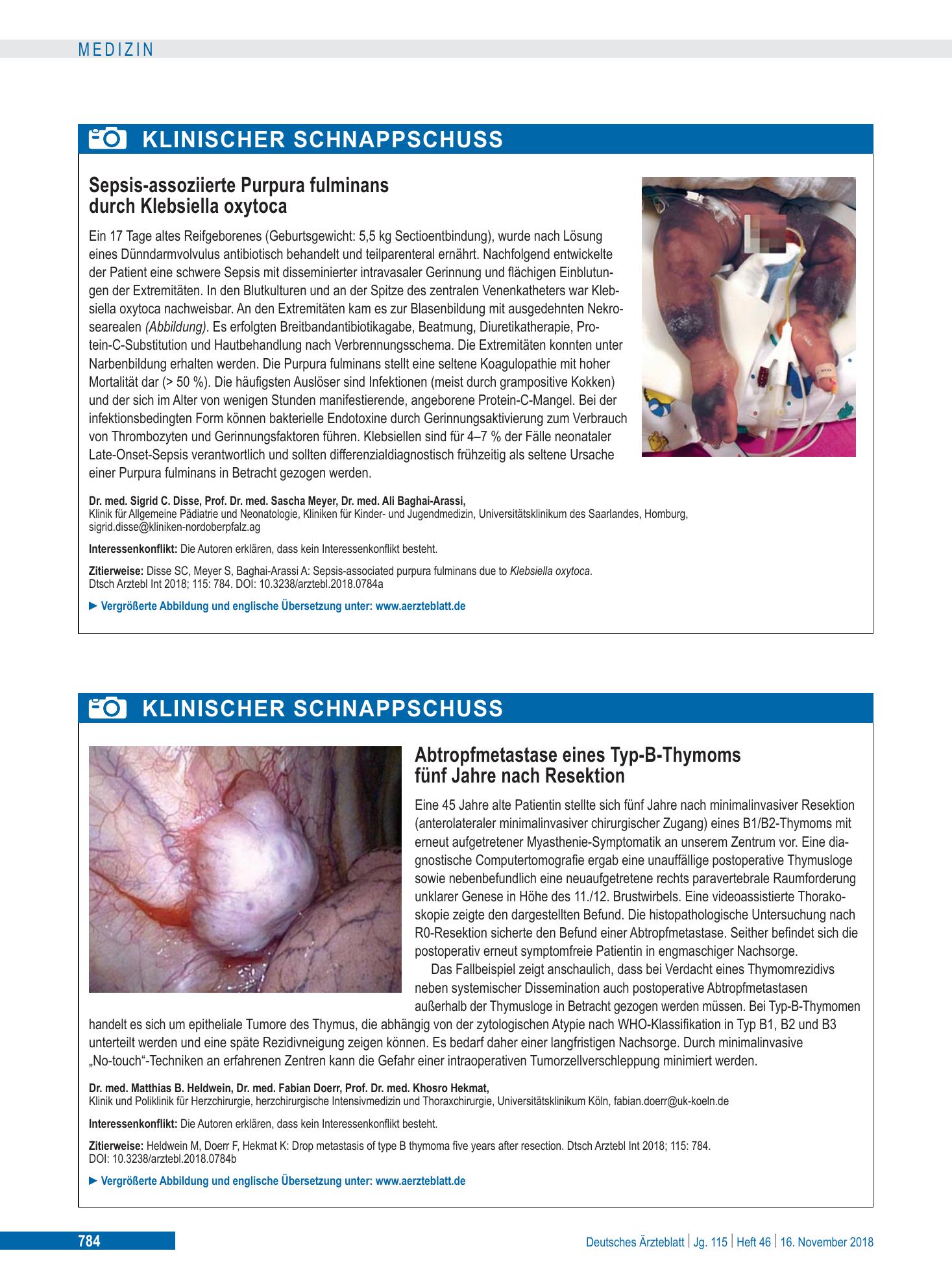 Vorschauseite 1: Abtropfmetastase eines Typ-B-Thymoms fünf Jahre nach Resektion – Deutsches Ärzteblatt