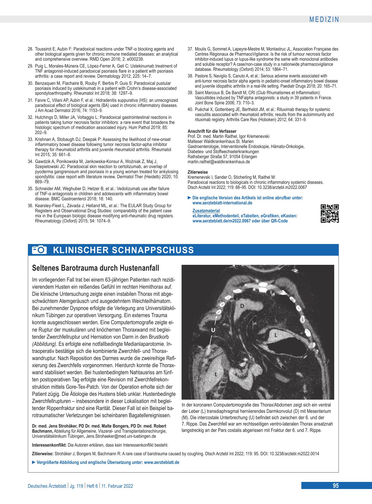 Vorschauseite 1: Seltenes Barotrauma durch Hustenanfall – Deutsches Ärzteblatt