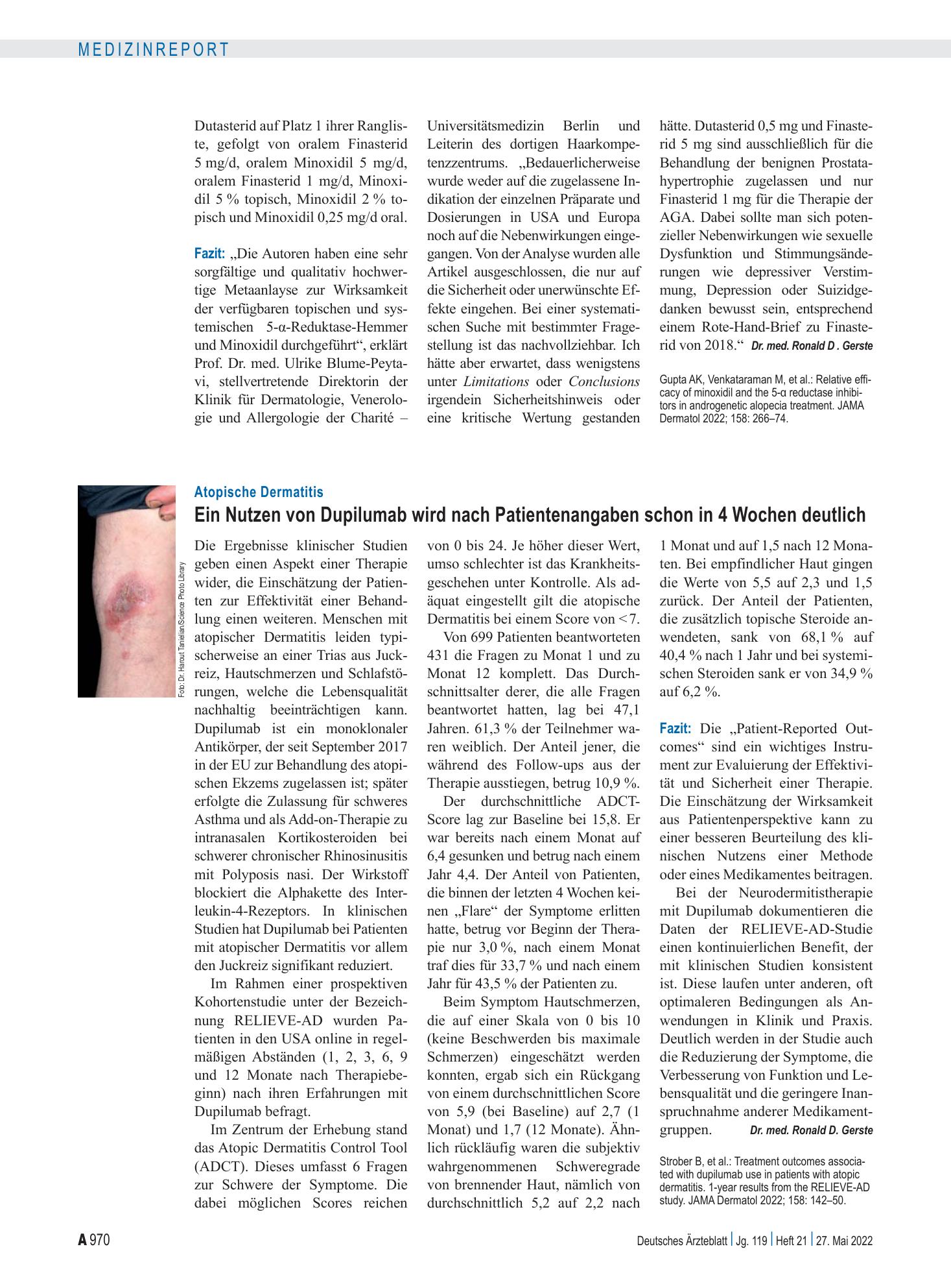 Vorschauseite 1: Atopische Dermatitis: Ein Nutzen von Dupilumab wird nach Patientenangaben schon in 4 Wochen deutlich – Deutsches Ärzteblatt