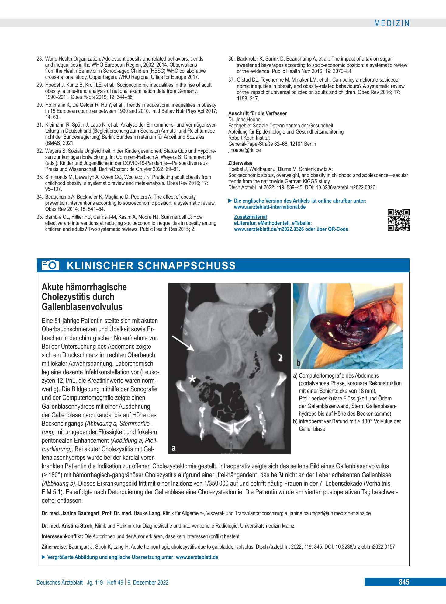 Vorschauseite 1: Akute hämorrhagische Cholezystitis durch Gallenblasenvolvulus – Deutsches Ärzteblatt