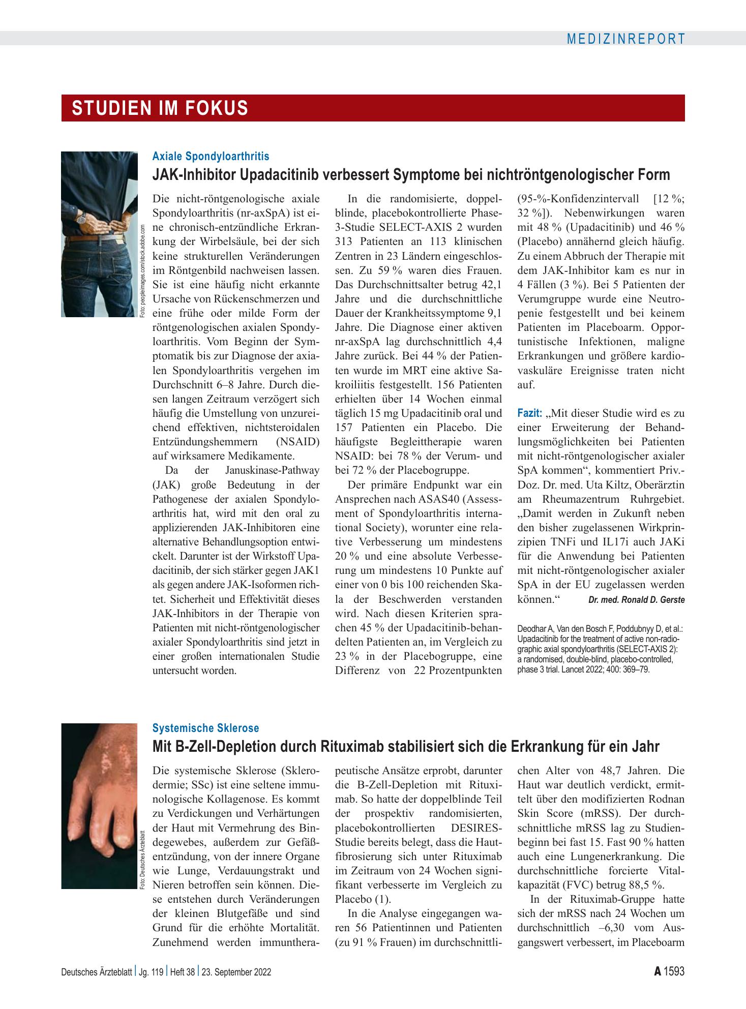 Vorschauseite 1: Axiale Spondyloarthritis: JAK-Inhibitor Upadacitinib verbessert Symptome bei nichtröntgenologischer Form – Deutsches Ärzteblatt
