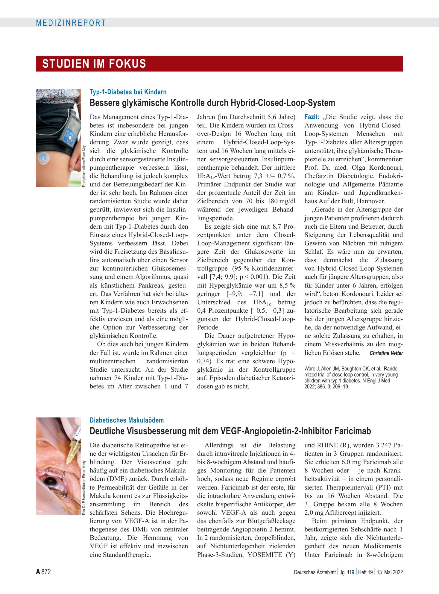 Vorschauseite 1: Typ-1-Diabetes bei Kindern: Bessere glykämische Kontrolle durch Hybrid-Closed-Loop-System – Deutsches Ärzteblatt