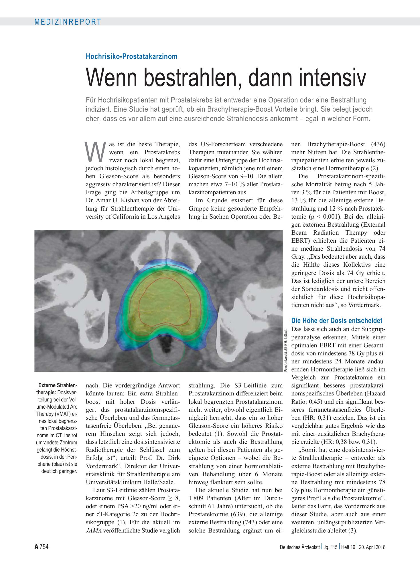 Vorschauseite 1: Hochrisiko-Prostatakarzinom: Wenn bestrahlen, dann intensiv – Deutsches Ärzteblatt