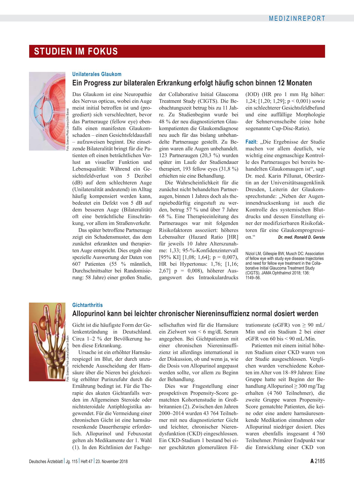 Vorschauseite 1: Gichtarthritis: Allopurinol kann bei leichter chronischer Niereninsuffizienz normal dosiert werden – Deutsches Ärzteblatt