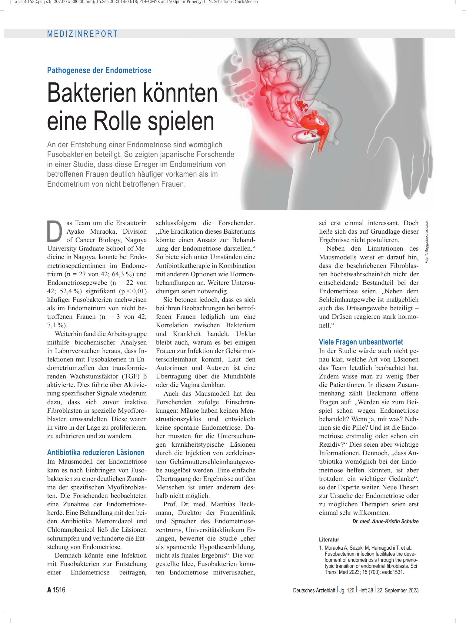 Vorschauseite 1: Pathogenese der Endometriose: Bakterien könnten eine Rolle spielen – Deutsches Ärzteblatt