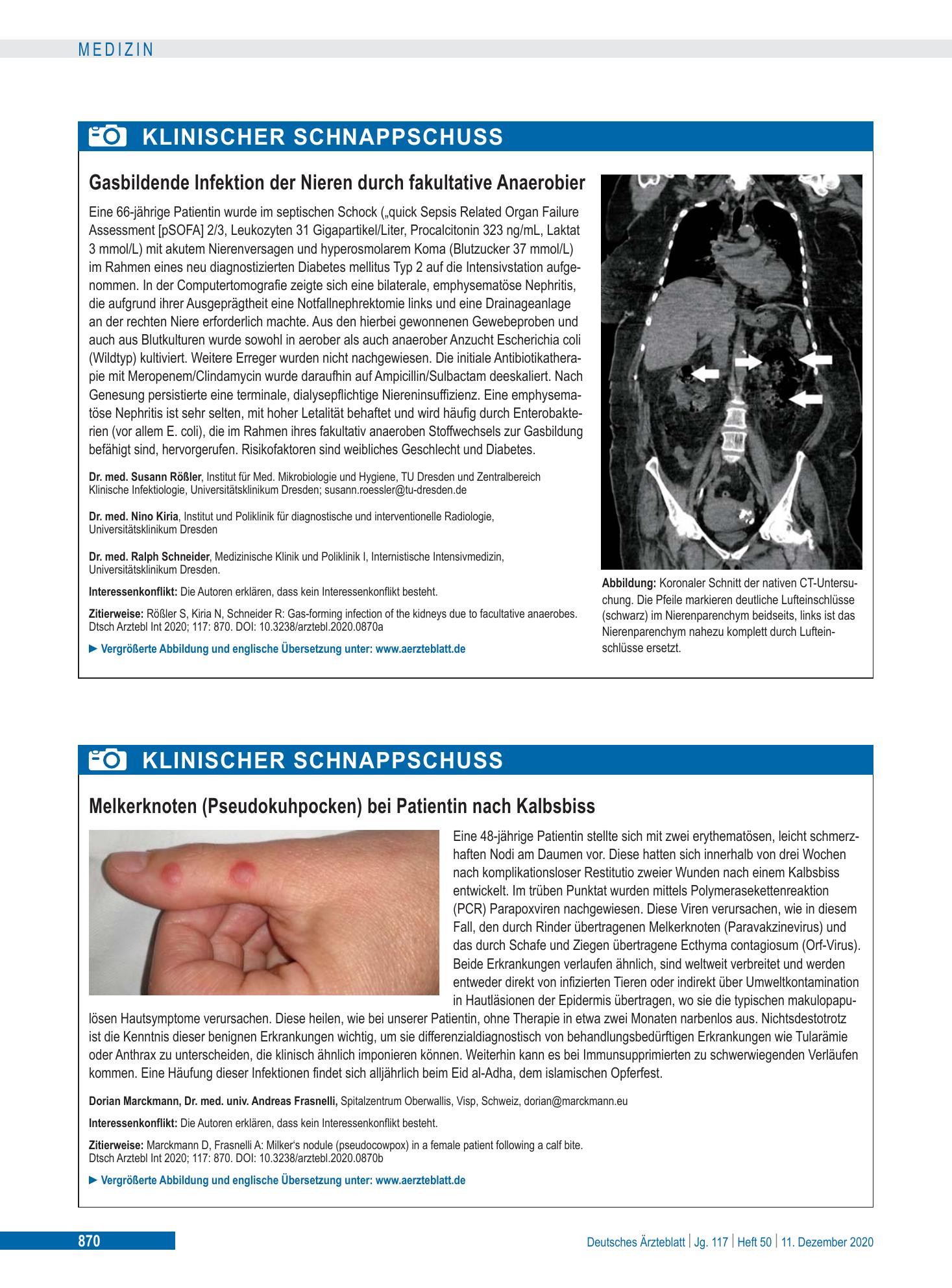 Vorschauseite 1: Melkerknoten (Pseudokuhpocken) bei Patientin nach Kalbsbiss – Deutsches Ärzteblatt