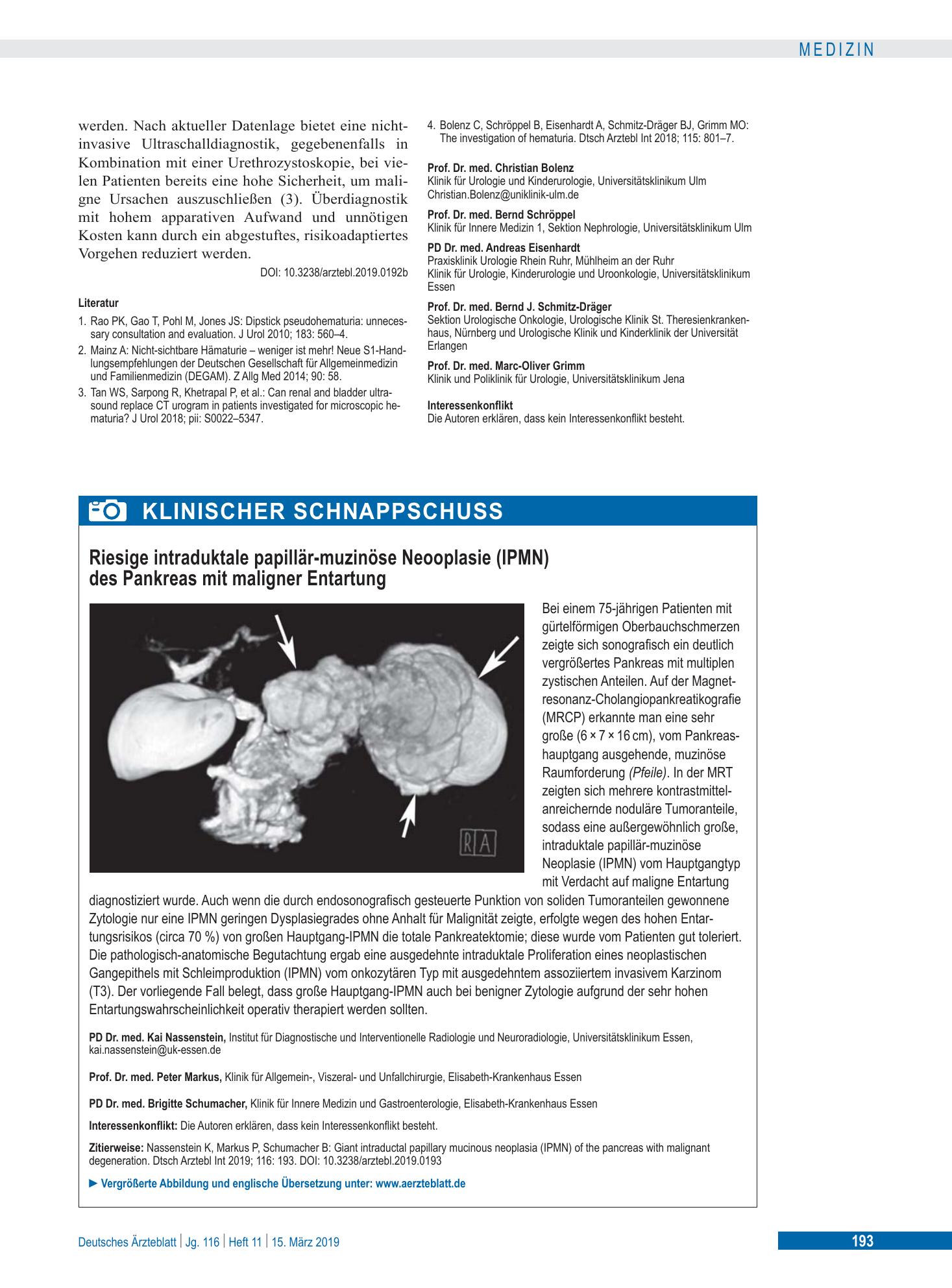 Vorschauseite 1: Riesige intraduktale papillär-muzinöse Neooplasie (IPMN) des Pankreas mit maligner Entartung – Deutsches Ärzteblatt