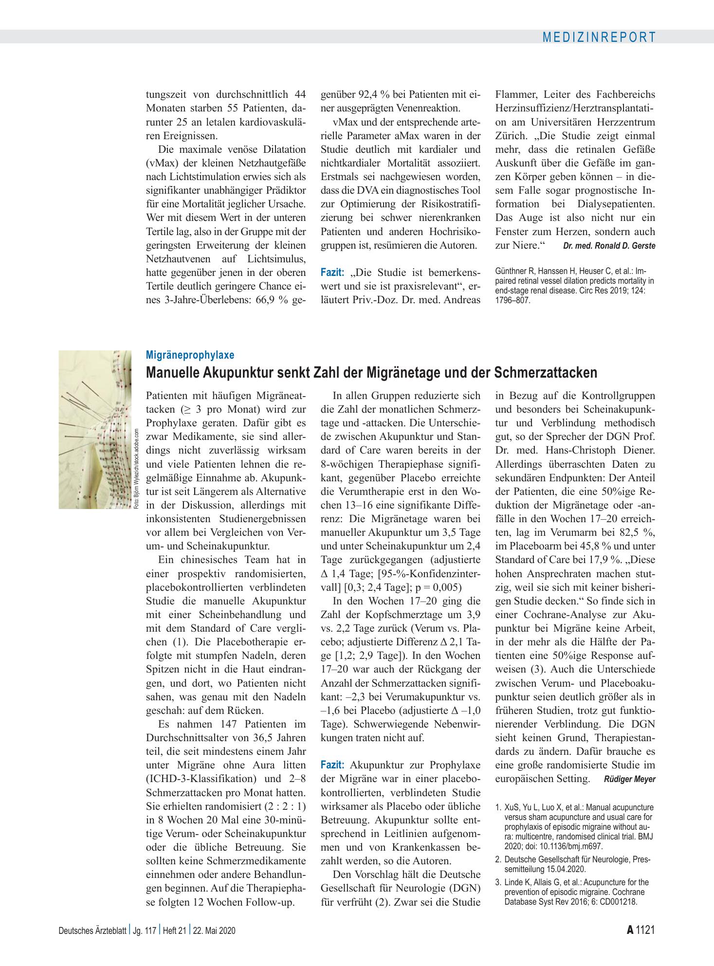 Vorschauseite 1: Migräneprophylaxe: Manuelle Akupunktur senkt Zahl der Migränetage und der Schmerzattacken – Deutsches Ärzteblatt