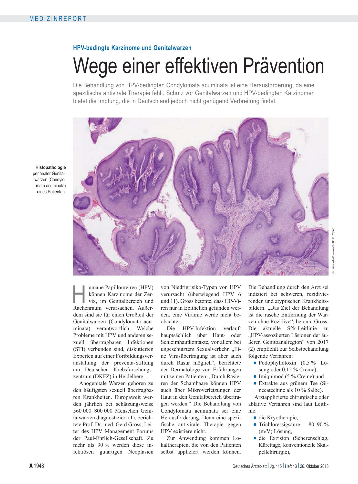 Vorschauseite 1: HPV-bedingte Karzinome und Genitalwarzen: Wege einer effektiven Prävention – Deutsches Ärzteblatt