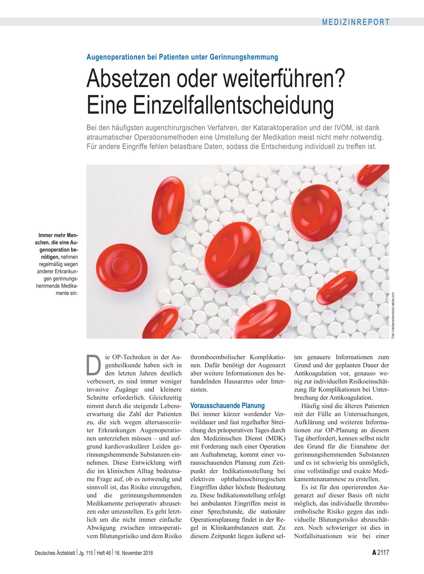 Vorschauseite 1: Augenoperationen bei Patienten unter Gerinnungshemmung: Absetzen oder weiterführen? Eine Einzelfallentscheidung – Deutsches Ärzteblatt