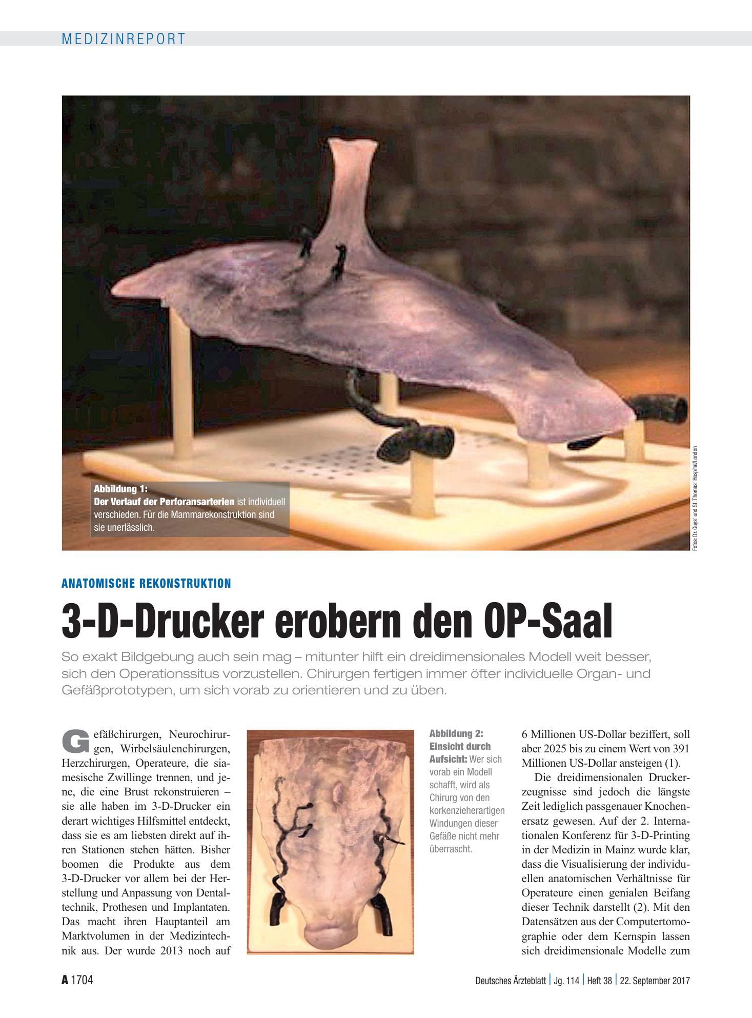 Vorschauseite 1: Anatomische Rekonstruktion: 3-D-Drucker erobern den OP-Saal – Deutsches Ärzteblatt