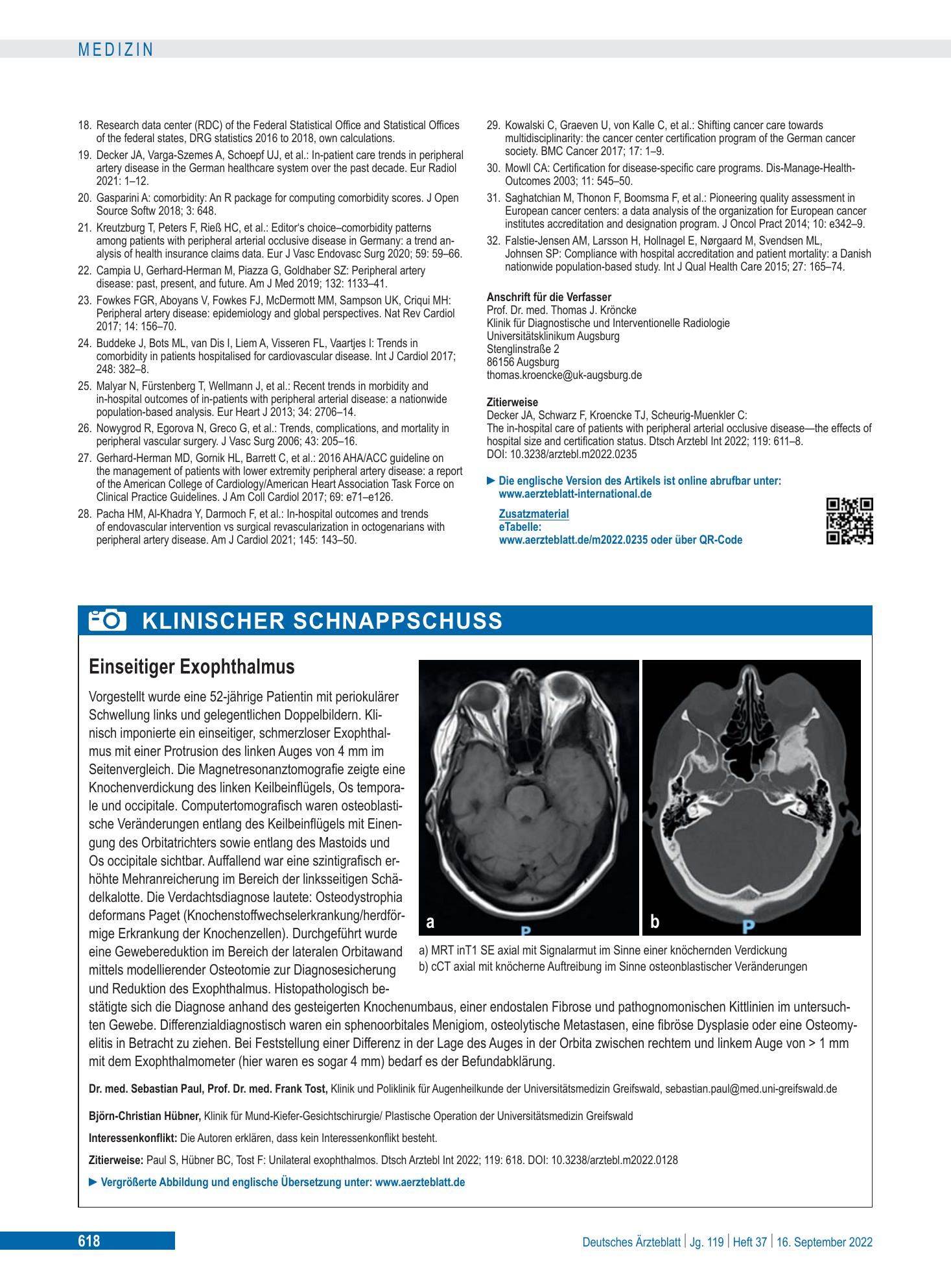 Vorschauseite 1: Einseitiger Exophthalmus – Deutsches Ärzteblatt