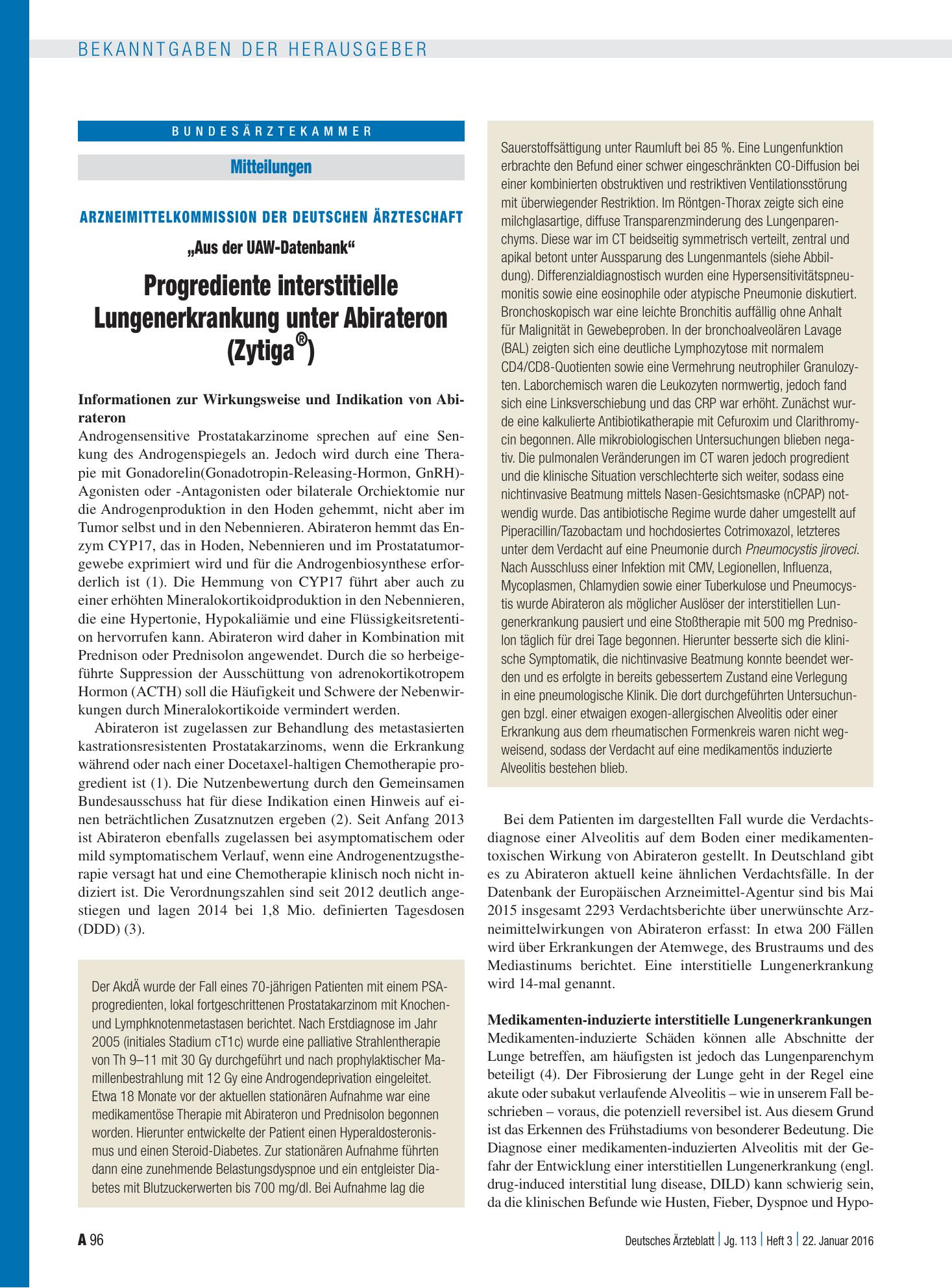 Vorschauseite 1: Arzneimittelkommission der Deutschen Ärzteschaft: „Aus der UAW-Datenbank“ Progrediente interstitielle Lungenerkrankung unter Abirateron (Zytiga ® ) – Deutsches Ärzteblatt