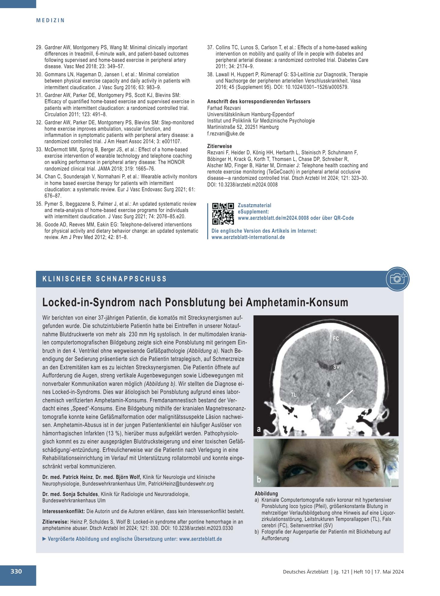 Vorschauseite 1: Locked-in-Syndrom nach Ponsblutung bei Amphetamin-Konsum – Deutsches Ärzteblatt