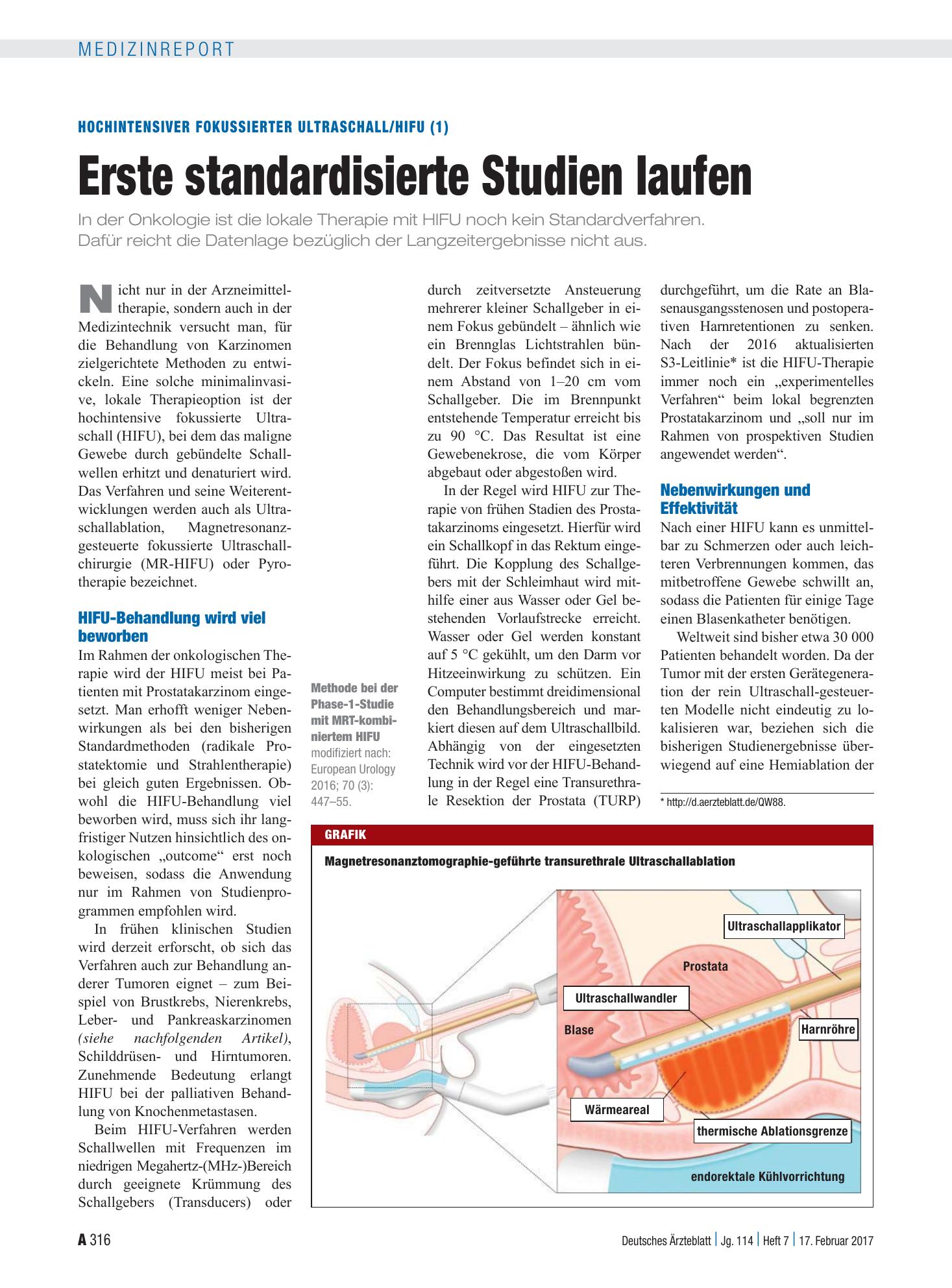 Vorschauseite 1: Hochintensiver fokussierter Ultraschall/HIFU (1): Erste standardisierte Studien laufen – Deutsches Ärzteblatt