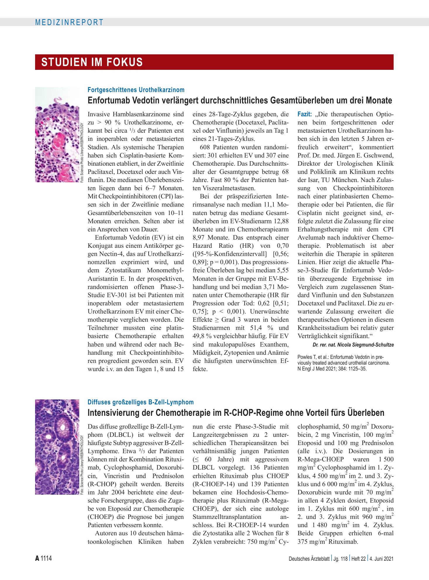 Vorschauseite 1: Fortgeschrittenes Urothelkarzinom: Enfortumab Vedotin verlängert durchschnittliches Gesamtüberleben um drei Monate – Deutsches Ärzteblatt