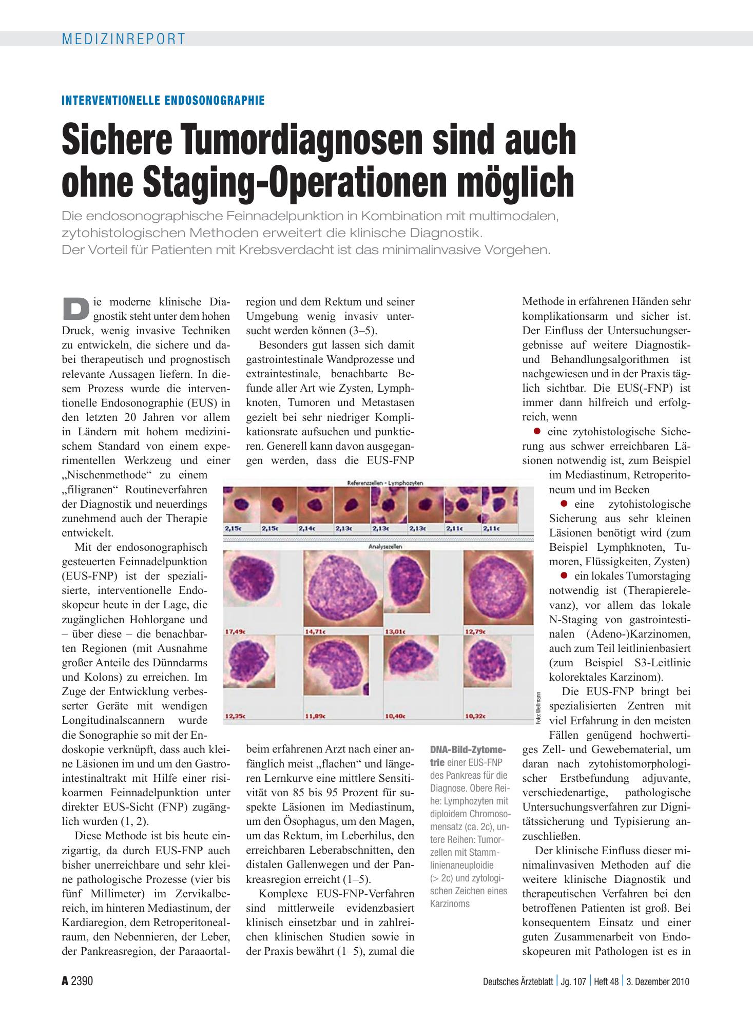 Vorschauseite 1: Interventionelle Endosonographie: Sichere Tumordiagnosen sind auch ohne Staging-Operationen möglich – Deutsches Ärzteblatt
