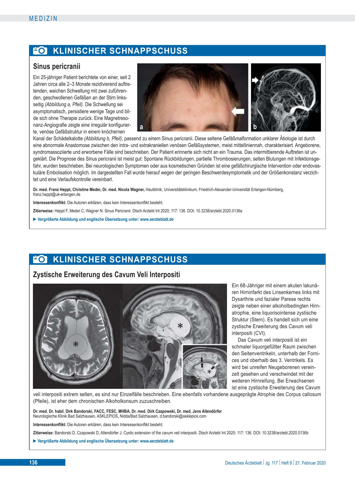 Vorschauseite 1: Sinus pericranii – Deutsches Ärzteblatt