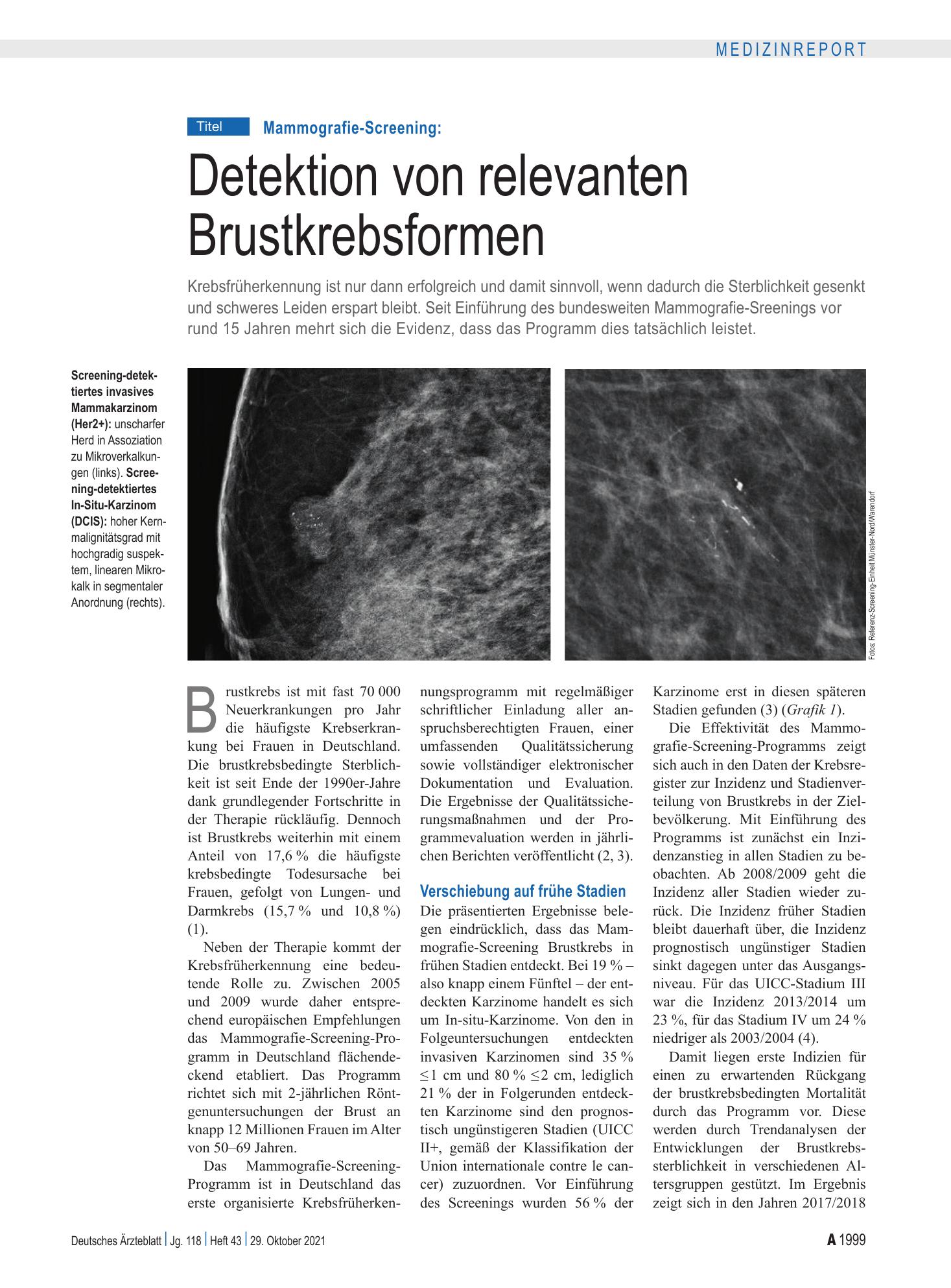 Vorschauseite 1: Mammografie-Screening: Detektion von relevanten Brustkrebsformen – Deutsches Ärzteblatt