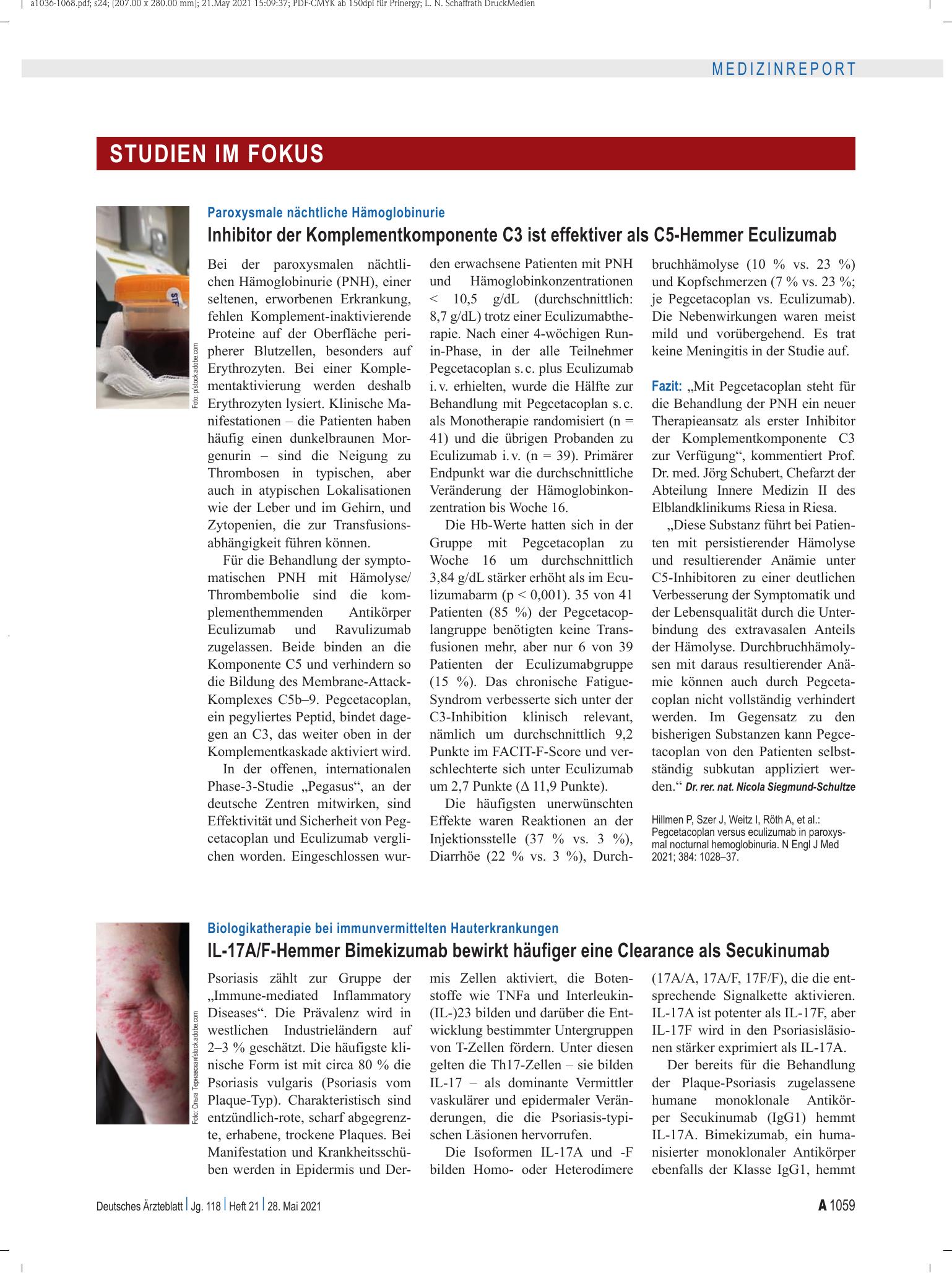 Vorschauseite 1: Paroxysmale nächtliche Hämoglobinurie: Inhibitor der Komplementkomponente C3 ist effektiver als C5-Hemmer Eculizumab – Deutsches Ärzteblatt
