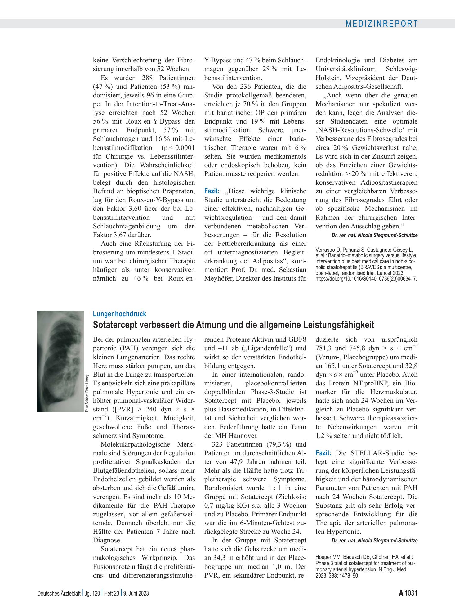 Vorschauseite 1: Lungenhochdruck: Sotatercept verbessert die Atmung und die allgemeine Leistungsfähigkeit – Deutsches Ärzteblatt