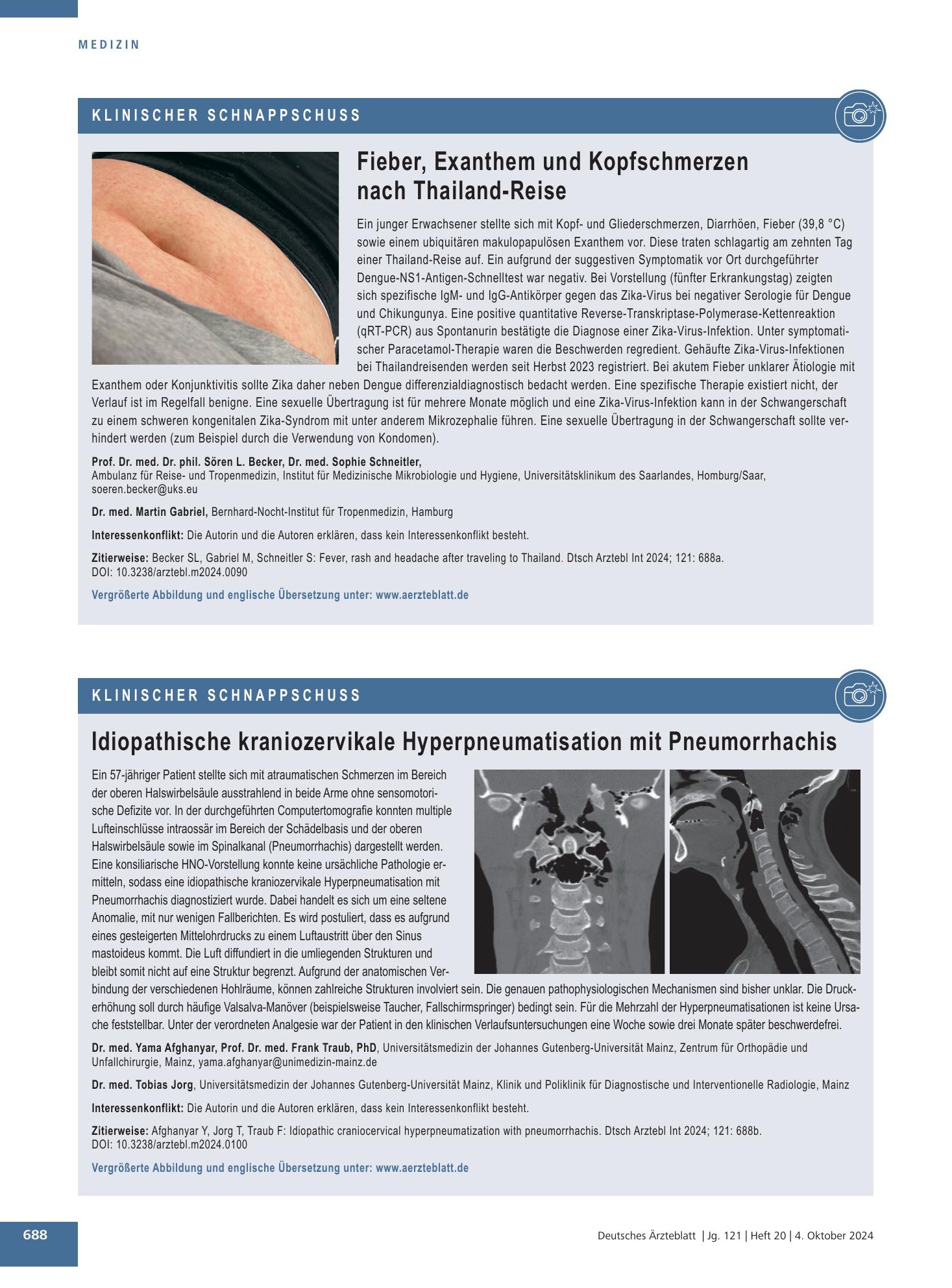 Vorschauseite 1: Idiopathische kraniozervikale Hyperpneumatisation mit Pneumorrhachis – Deutsches Ärzteblatt