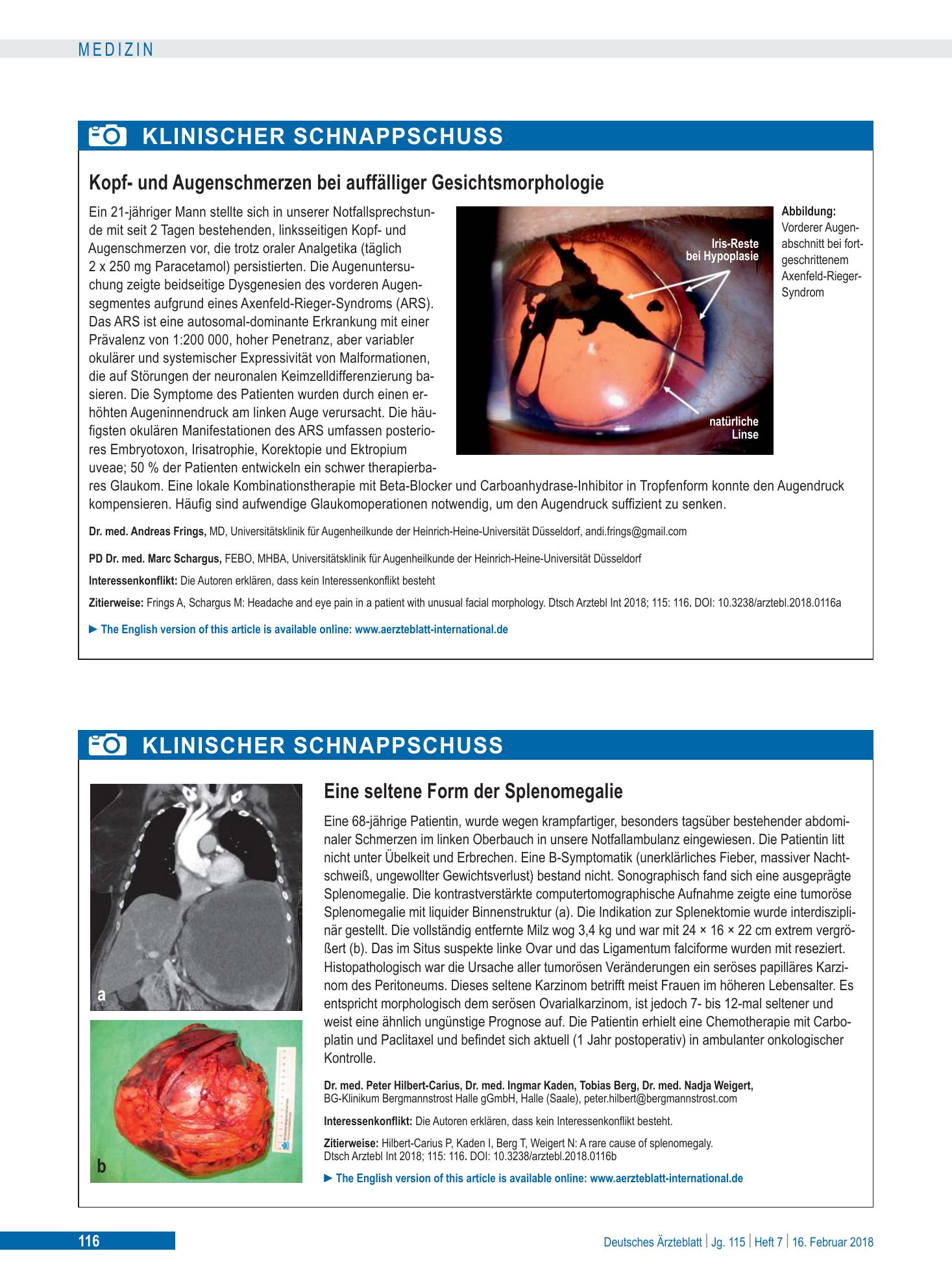Vorschauseite 1: Eine seltene Form der Splenomegalie – Deutsches Ärzteblatt