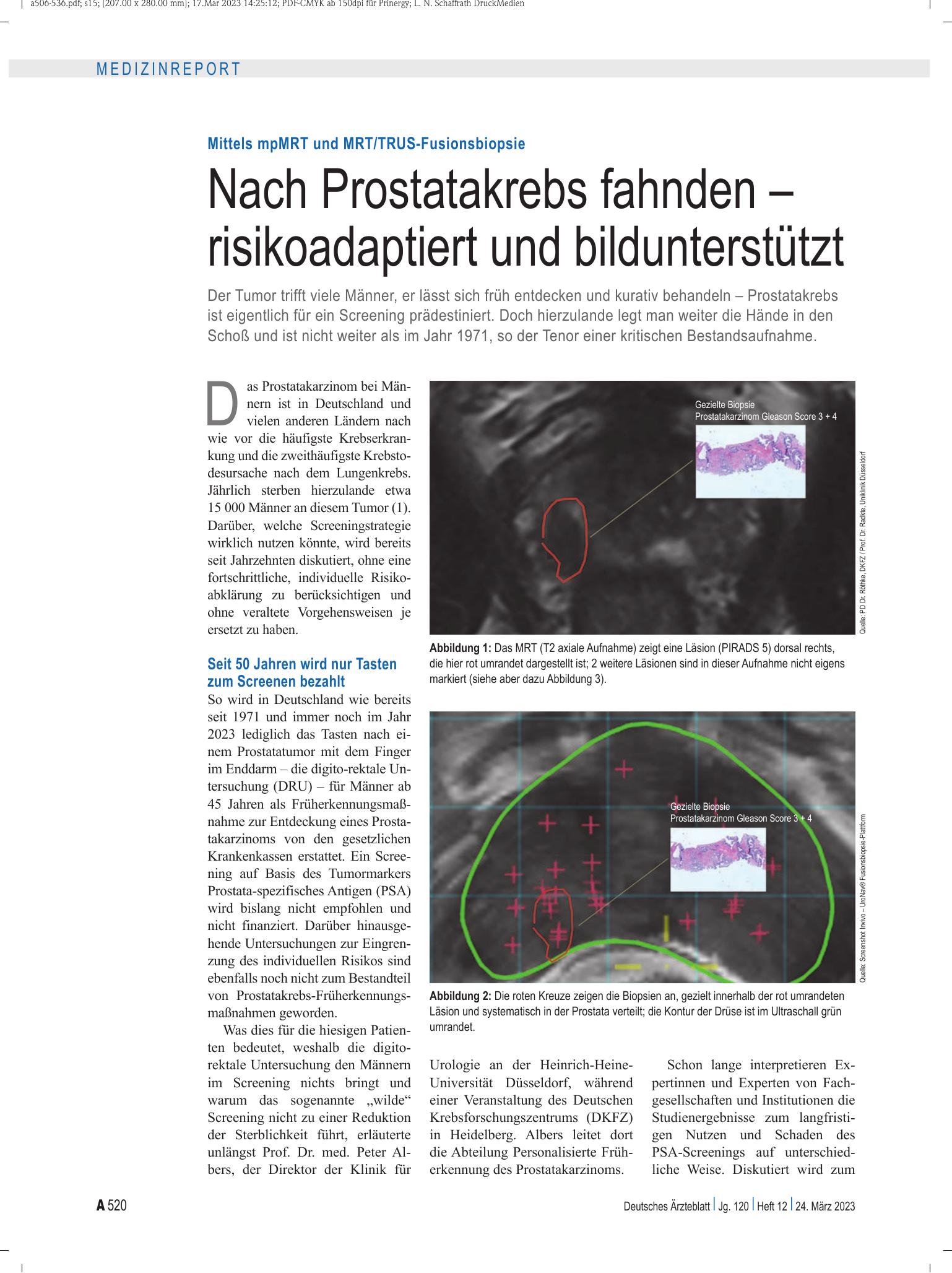 Vorschauseite 1: Mittels mpMRT und MRT/TRUS-Fusionsbiopsie: Nach Prostatakrebs fahnden – risikoadaptiert und bildunterstützt – Deutsches Ärzteblatt