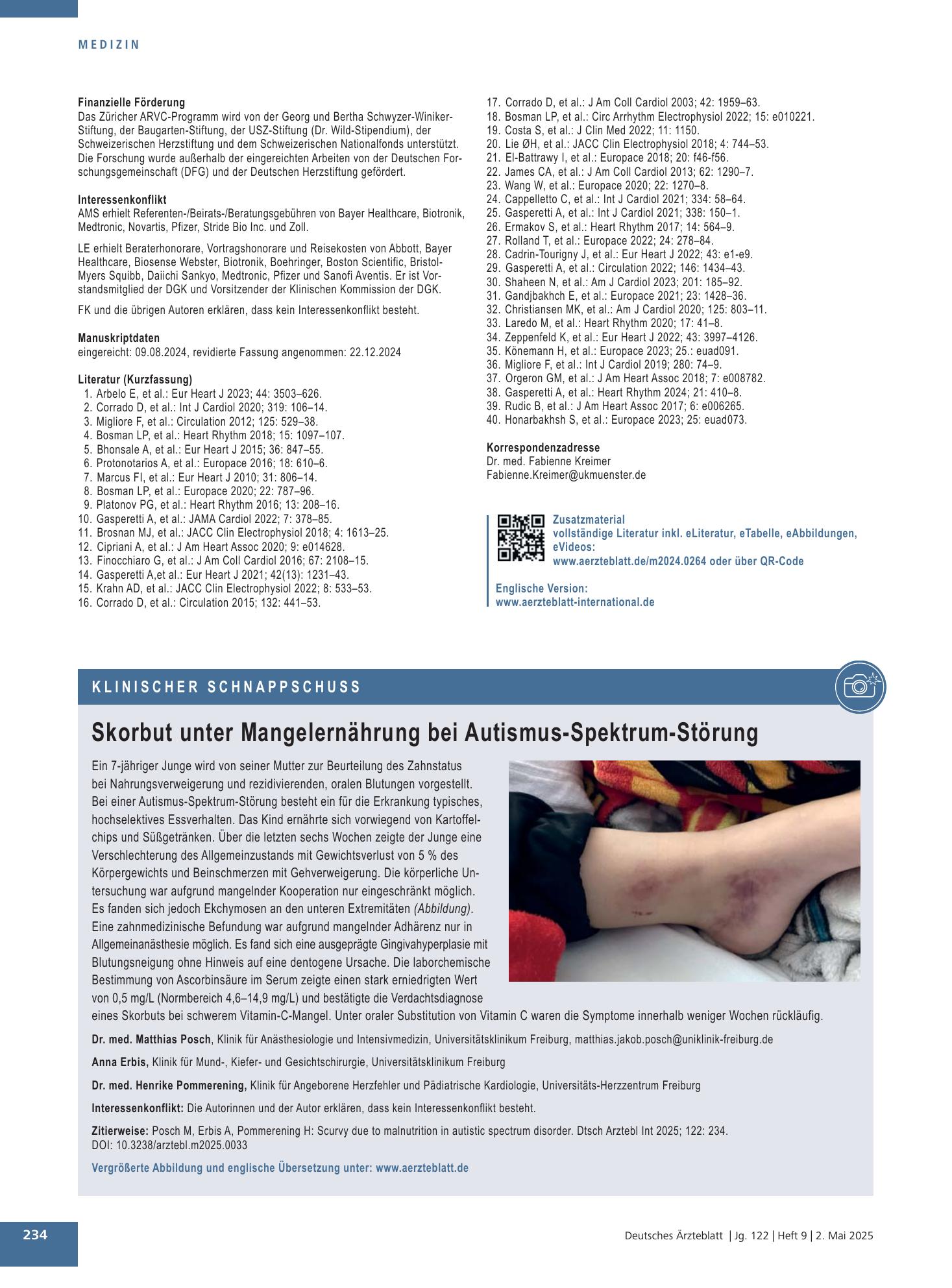 Vorschauseite 1: Skorbut unter Mangelernährung bei Autismus-Spektrum-Störung – Deutsches Ärzteblatt