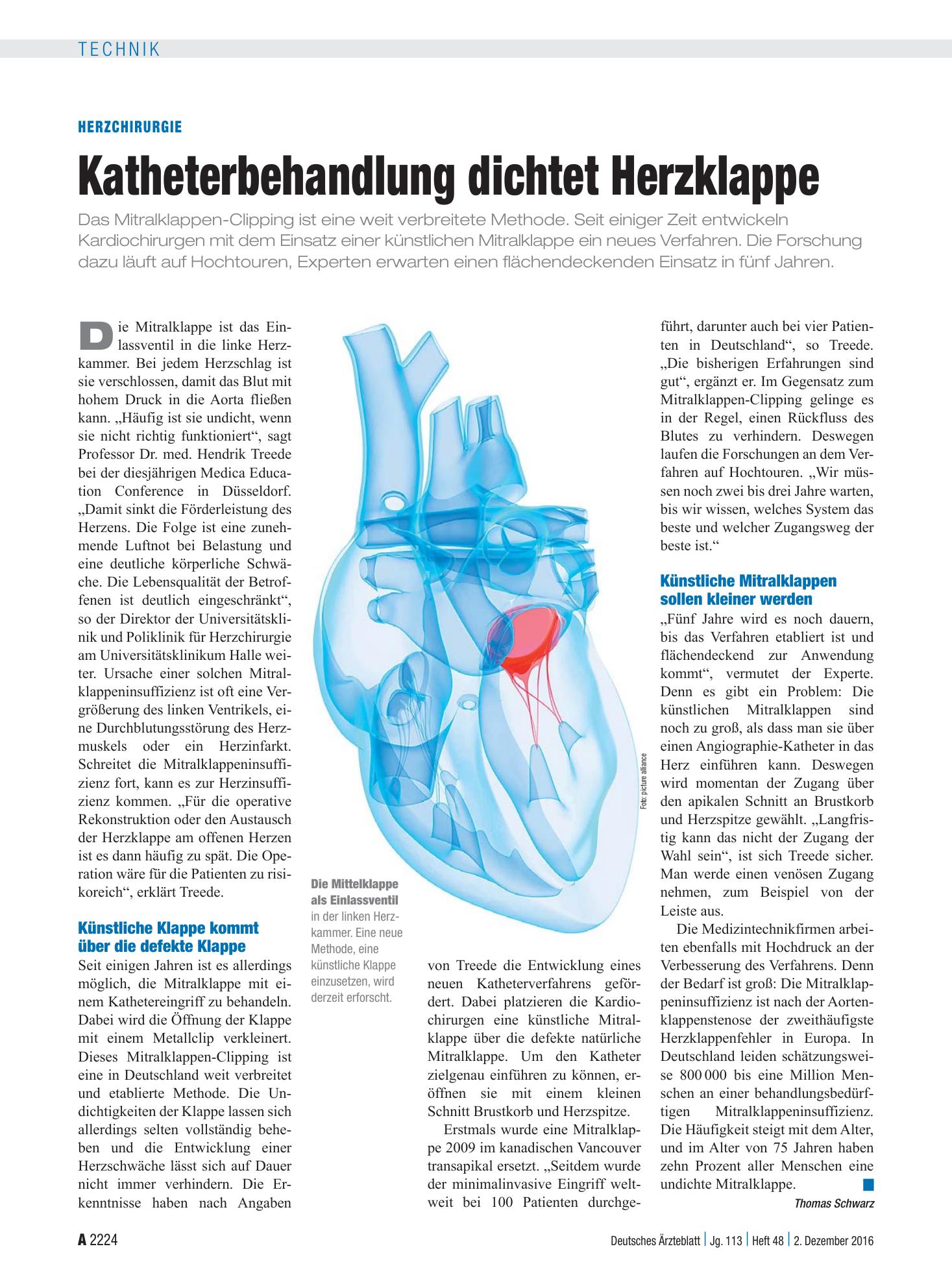 Vorschauseite 1: Herzchirurgie: Katheterbehandlung dichtet Herzklappe – Deutsches Ärzteblatt