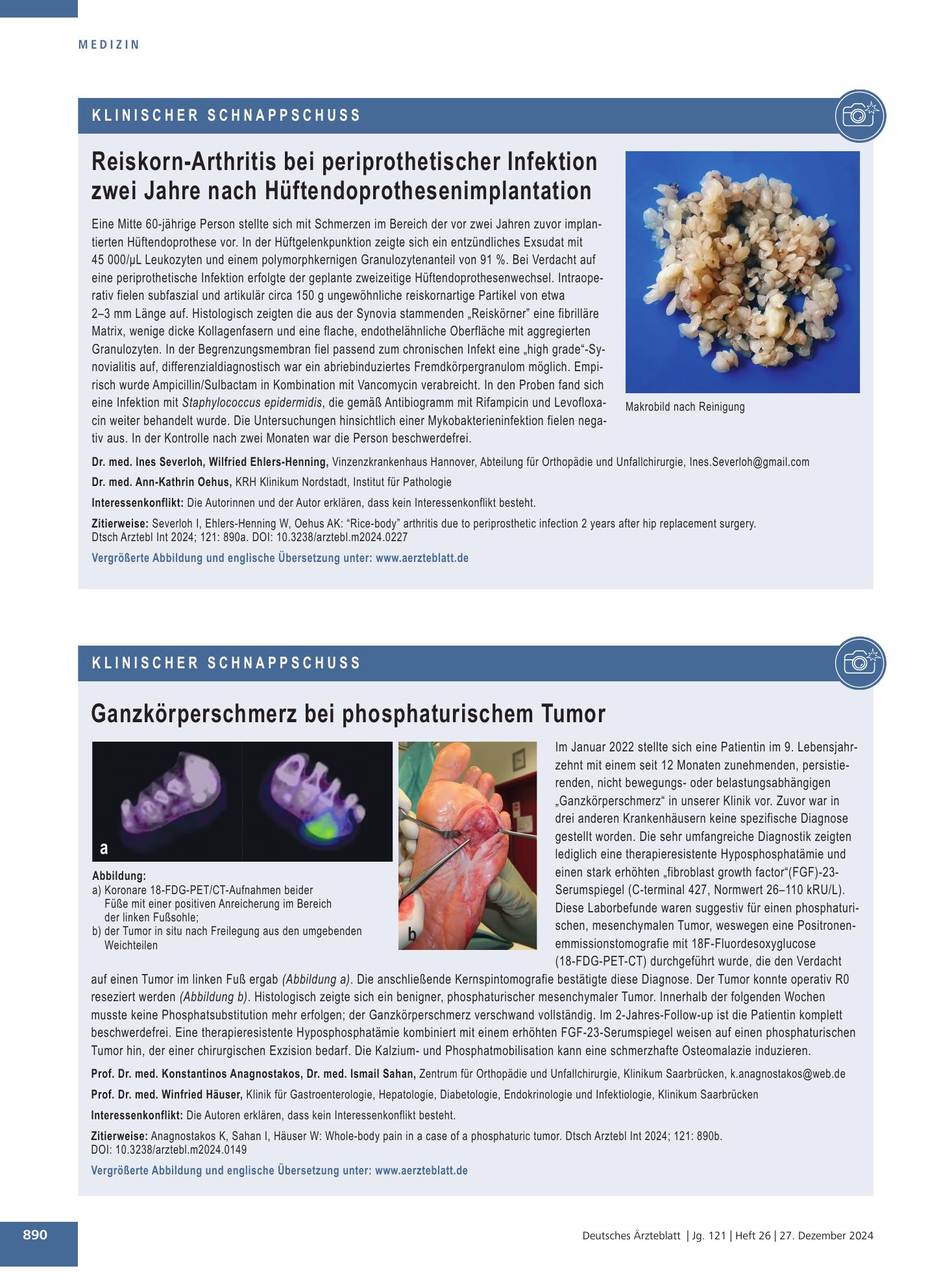 Vorschauseite 1: Ganzkörperschmerz bei phosphaturischem Tumor – Deutsches Ärzteblatt