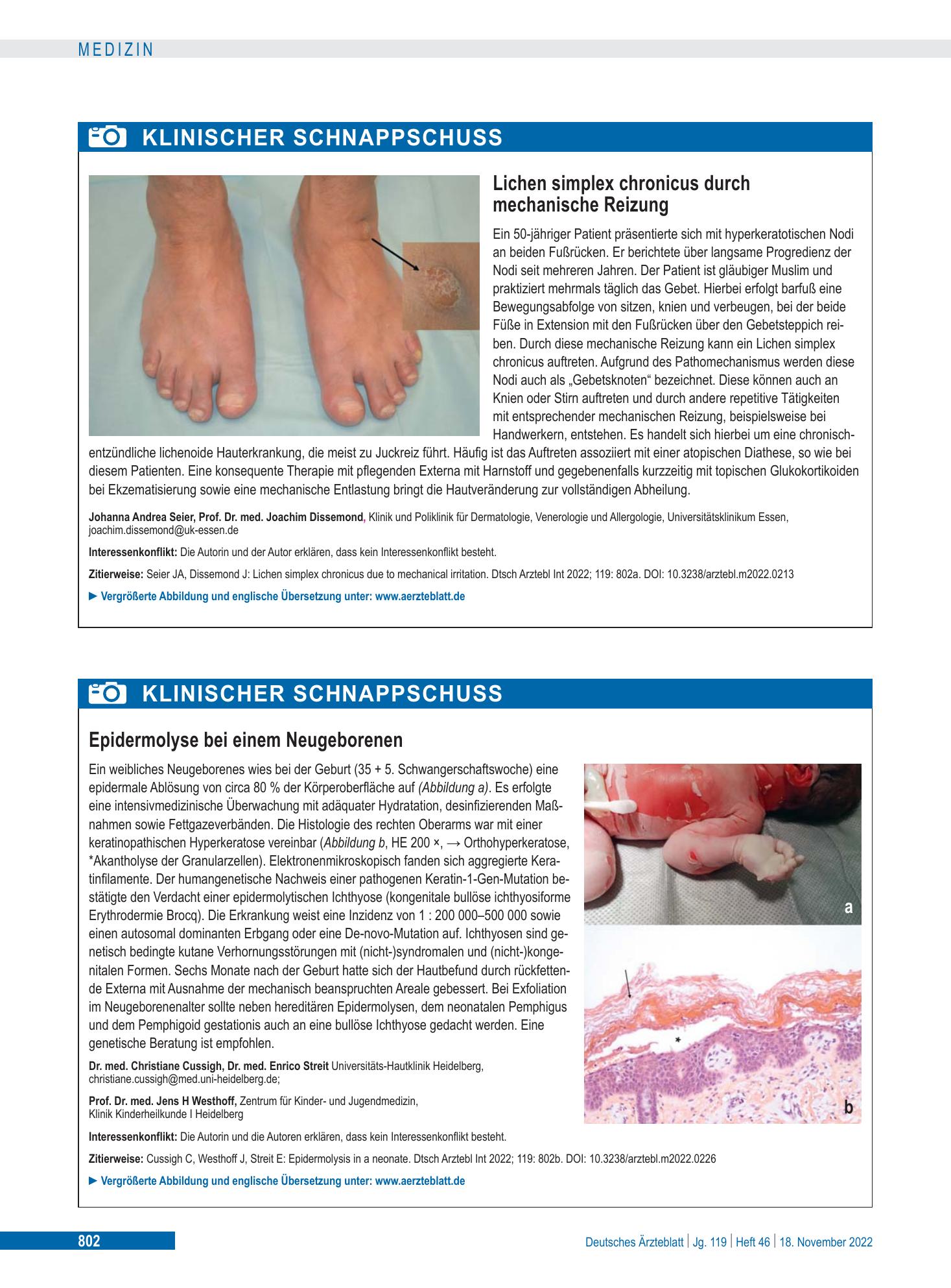 Vorschauseite 1: Epidermolyse bei einem Neugeborenen – Deutsches Ärzteblatt