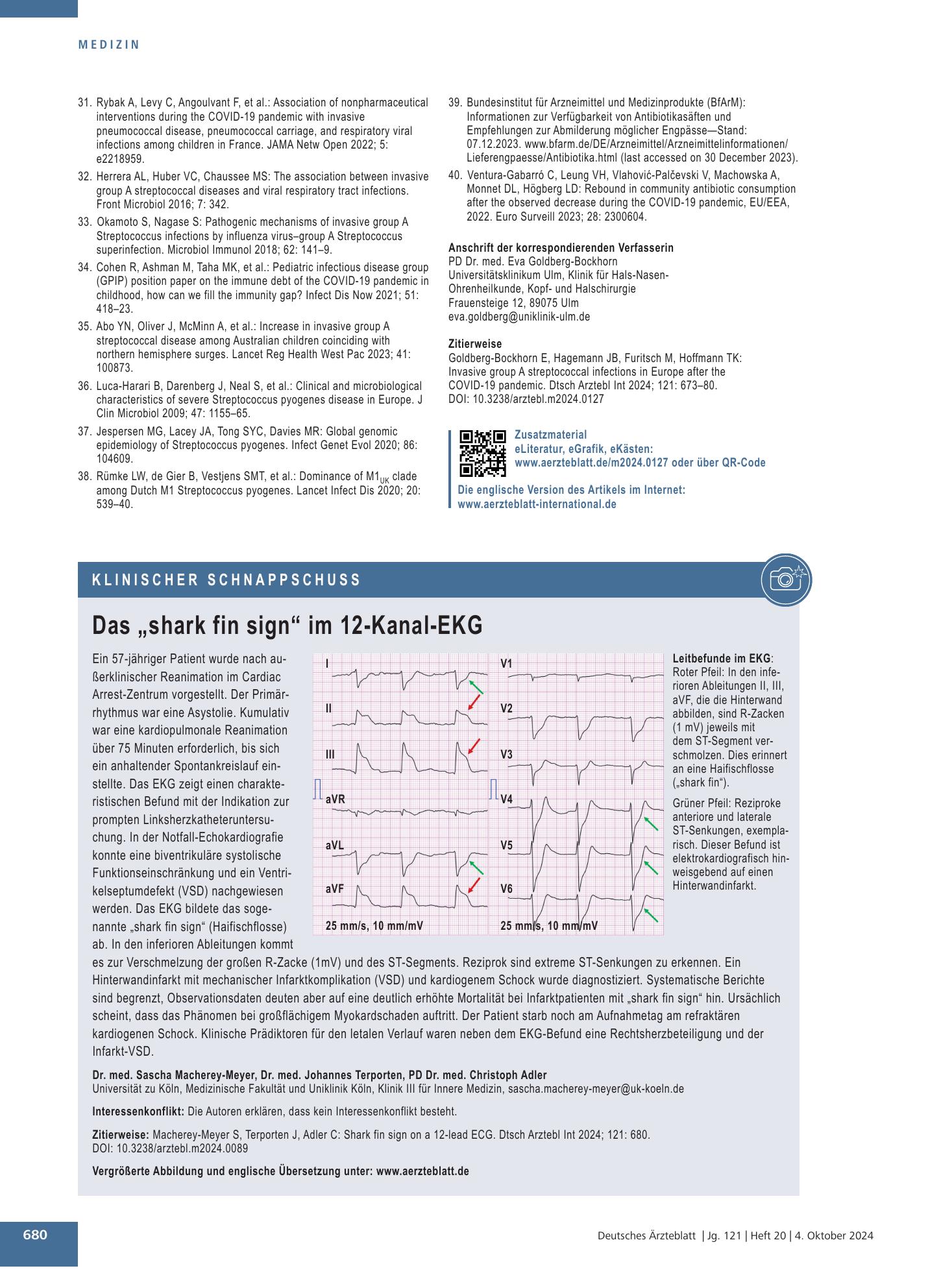 Vorschauseite 1: Das „shark fin sign“ im 12-Kanal-EKG – Deutsches Ärzteblatt