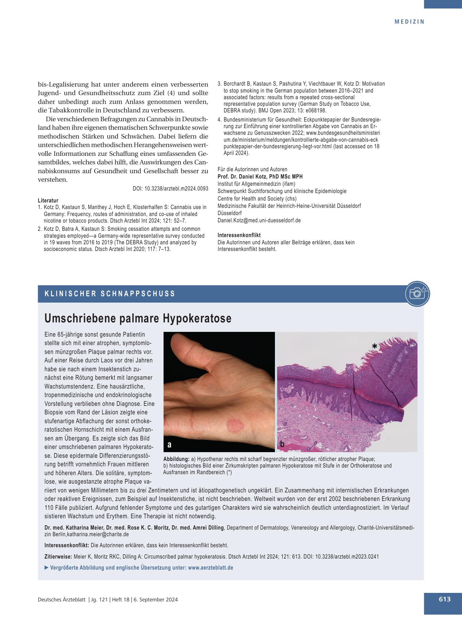 Vorschauseite 1: Umschriebene palmare Hypokeratose – Deutsches Ärzteblatt