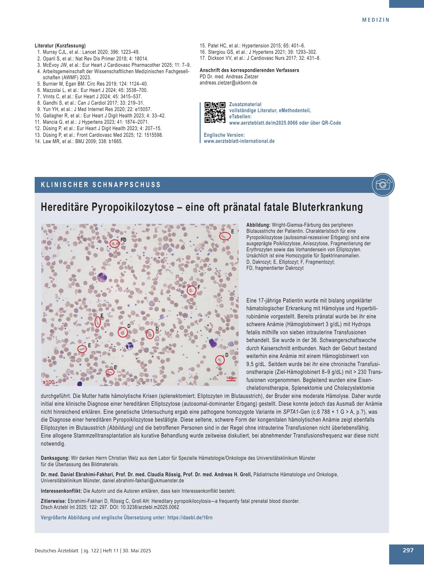 Vorschauseite 1: Hereditäre Pyropoikilozytose – eine oft pränatal fatale Bluterkrankung – Deutsches Ärzteblatt