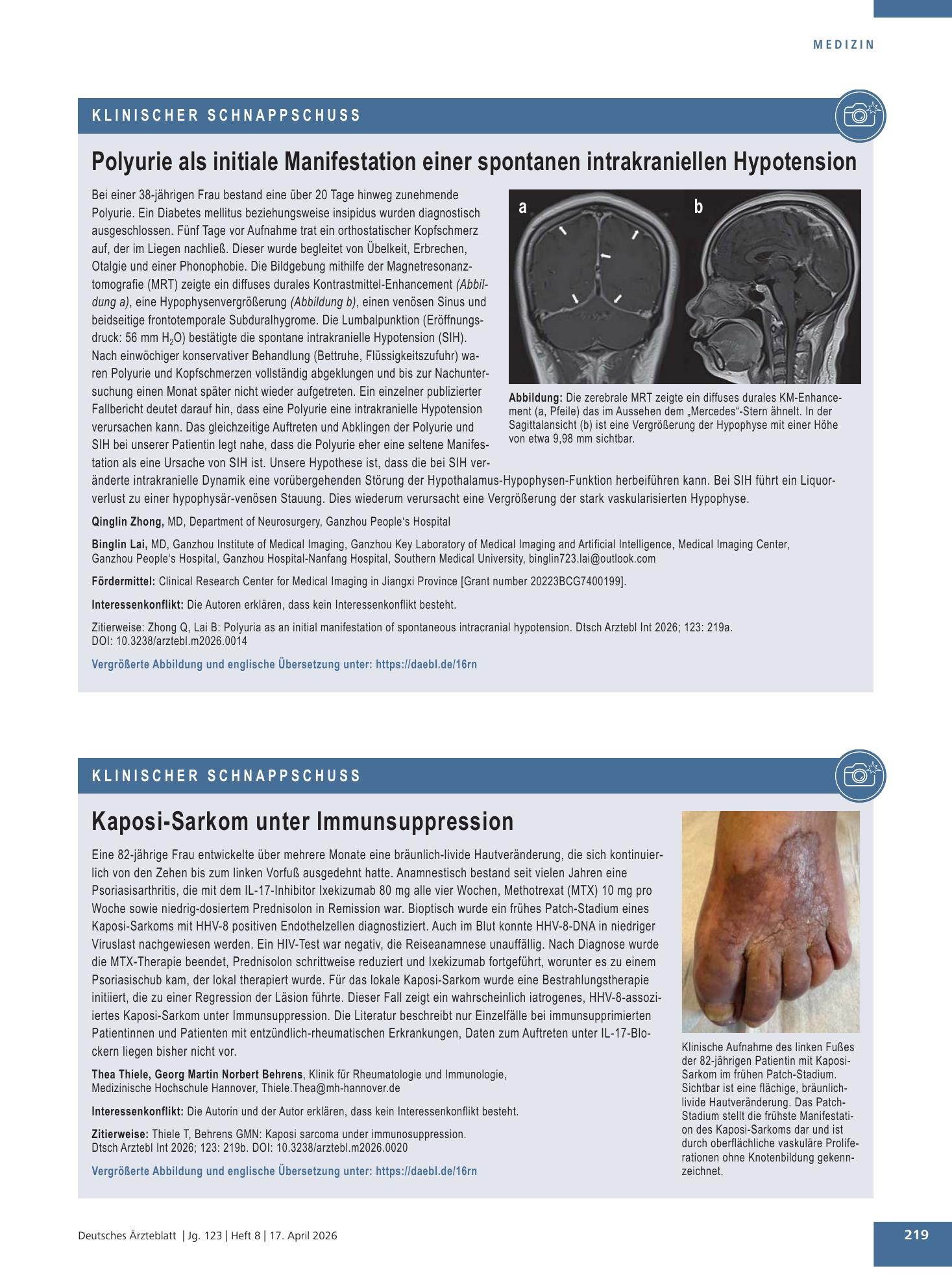 Vorschauseite 1: Kaposi-Sarkom unter Immunsuppression – Deutsches Ärzteblatt